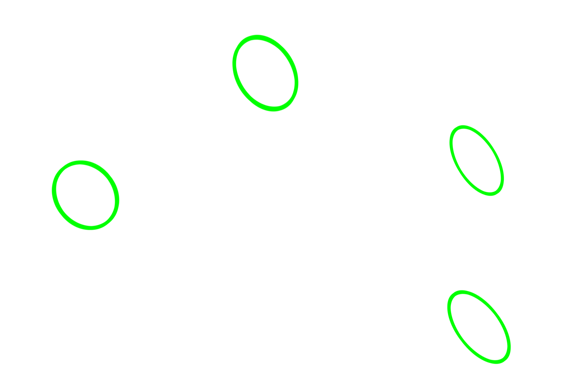 Neuromuscular junctions > <p>Contraction of skeletal muscle is initiated by depolarization of the sarcolemma at the neuromuscular junction (NMJ) or motor end plate. NMJs are specialized synapses between axon terminals of multipolar motor neurons and the sarcolemma beneath them.  Here, several axons are terminating in NMJs on skeletal muscle fibers.  The motor neuron plus all the skeletal muscle fibers it innervates is a motor unit.</p>
