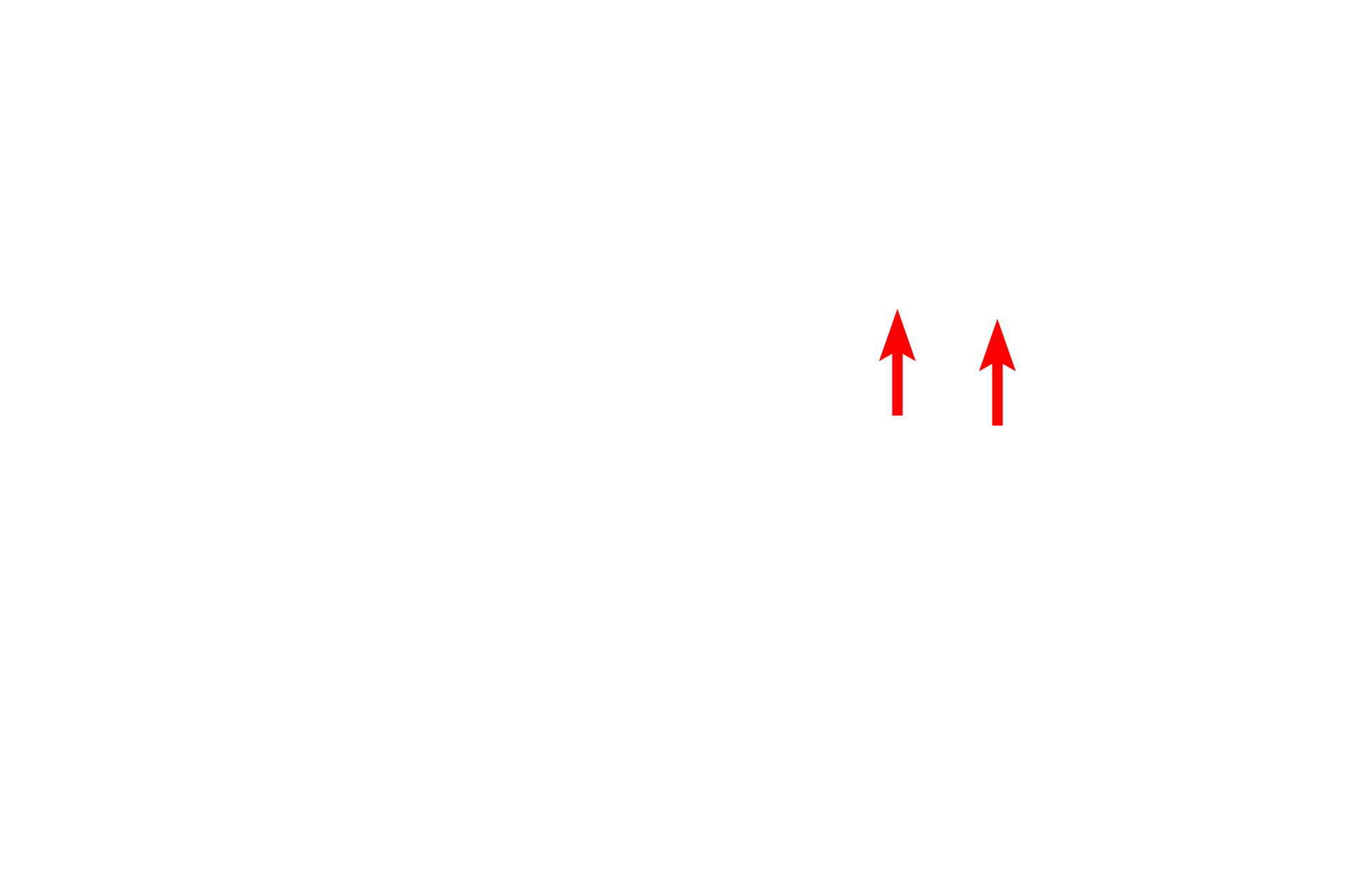 Post-synaptic density <p>This electron micrograph shows the terminal bouton of a synapse terminating on a dendritic spine.  Dendritic spines provide sites for excitatory input to the neuron.  Note the transmitter vesicles and the well-developed post-synaptic density in the bouton.  25,000x</p>
