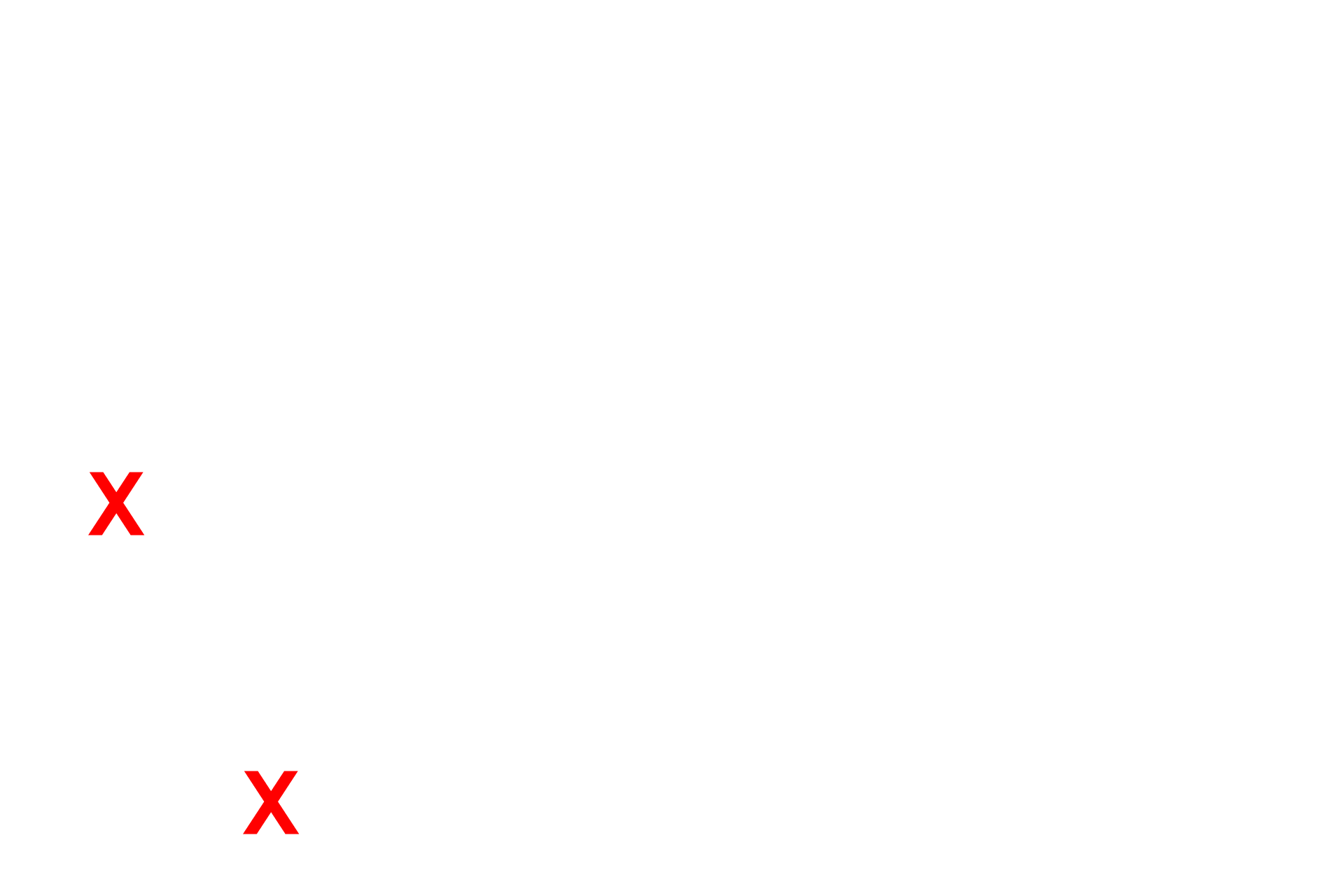 Shaft of the dendrite <p>This electron micrograph shows the terminal bouton of a synapse terminating on a dendritic spine.  Dendritic spines provide sites for excitatory input to the neuron.  Note the transmitter vesicles and the well-developed post-synaptic density in the bouton.  25,000x</p>
