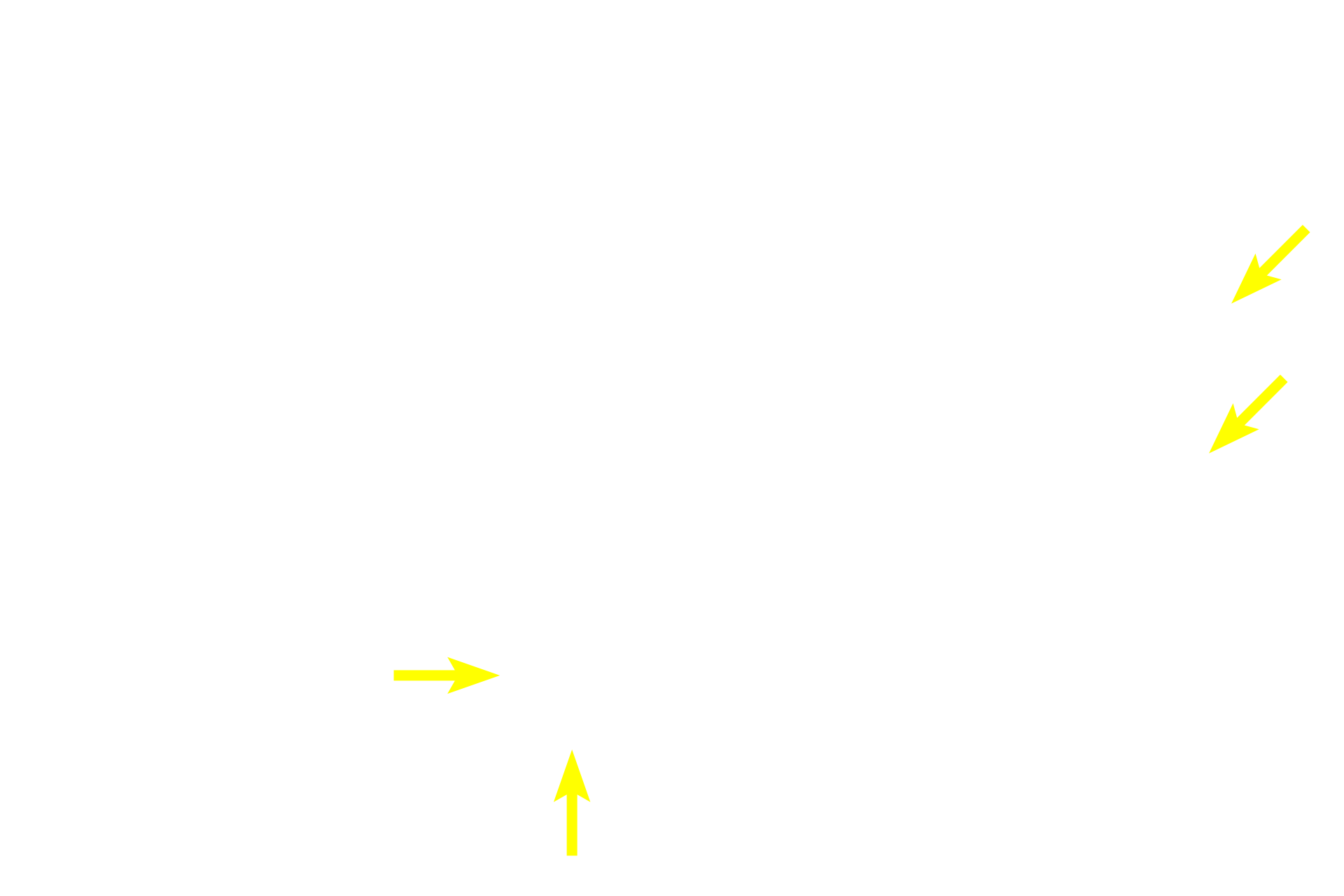 Astrocytic end feet <p>Astrocytes extend processes to capillaries and form “end-feet” which partially encircle the capillary.  Similar contacts are also made on neurons.  By these contacts, astrocytes help regulate metabolic and ionic homeostasis in the CNS.  These images show fibrous astrocytes stained by a special gold-deposition technique called the Cajal method.  1000x</p>

