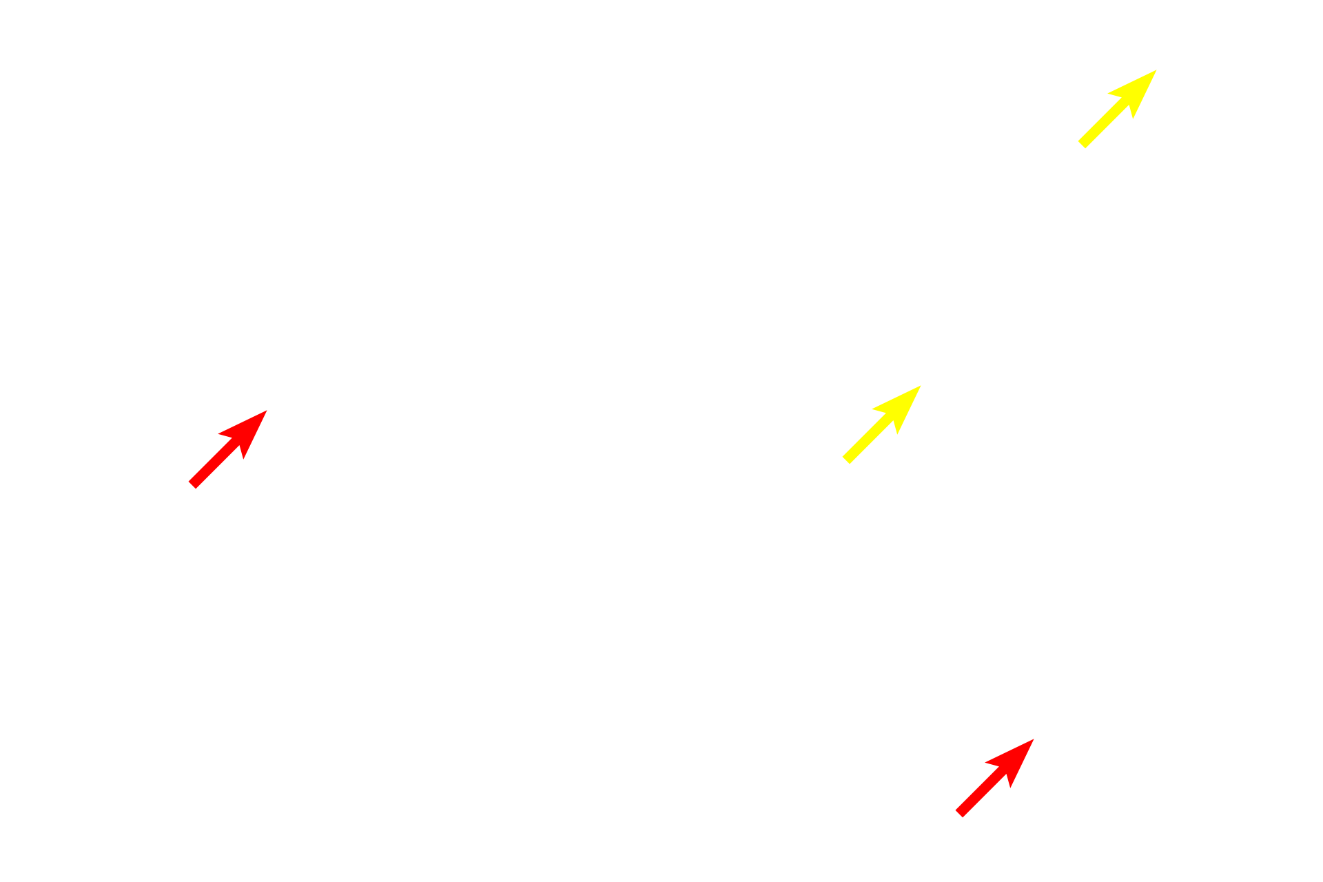 Oligodendrocytes > <p>Because this is a section of developing rat spinal cord, some of the oligodendrocytes are still immature (red arrows).  In these cells, the nuclei are larger and more euchromatic and the cytoplasm is more extensive than that in the more mature oligodendrocytes (yellow arrows).  Also visible are the pale-staining nuclei of astrocytes.</p>
