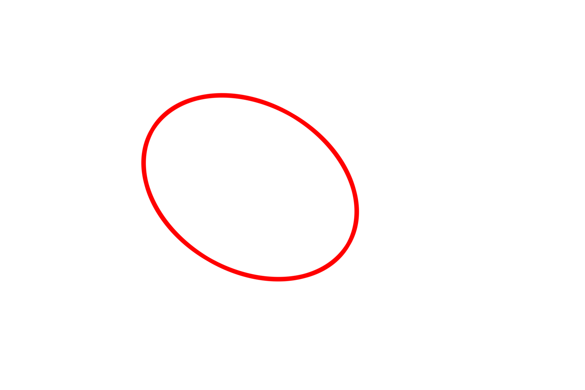 Multipolar neuron <p>Because this is a section of developing rat spinal cord, some of the oligodendrocytes are still immature (red arrows).  In these cells, the nuclei are larger and more euchromatic and the cytoplasm is more extensive than that in the more mature oligodendrocytes (yellow arrows).  Also visible are the pale-staining nuclei of astrocytes.</p>
