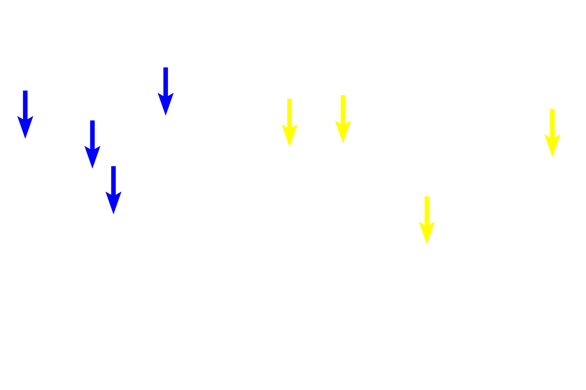Oligodendrocytes <p>This image compares interfascicular oligodendrocytes as revealed by conventional H & E staining (left) with those immunostained for an oligodendrocyte-specific protein (right).  This fluorescent image shows oligodendrocyte cell bodies, their cytoplasm and cell processes, each of which contacts an axon and produces a single internode of myelin.  (Fluorescent image courtesy of Dr. Babette Fuss)  1000x, 1000x.</p>
