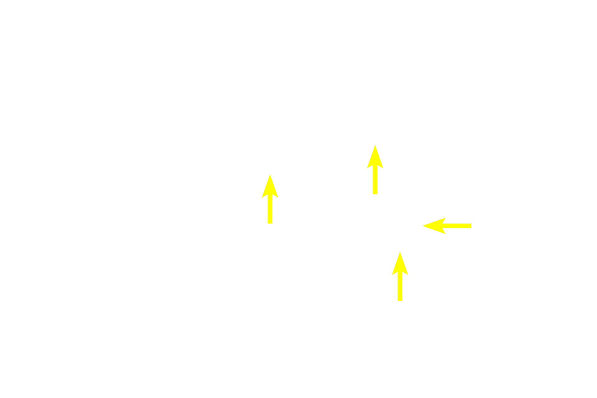 Oligodendrocyte processes > <p>Each oligodendrocyte extends numerous, branched processes.  Each branch contacts and wraps around an axon, forming a single internodal segment of myelin.  Each oligodendrocyte myelinates multiple axons, up to 40 in some regions of the brain.  These processes are not visible by conventional H & E staining methods.</p>
