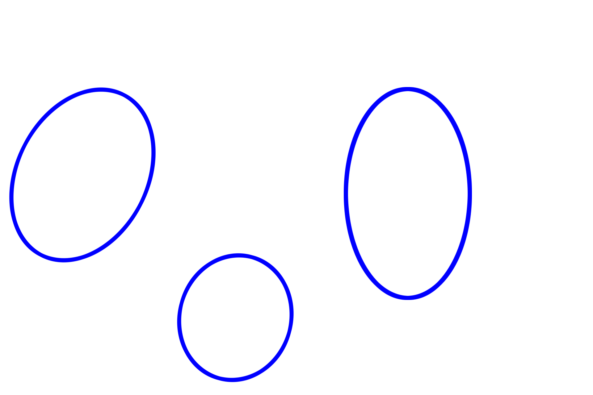 Microglia <p>Microglial cells function as macrophages in the CNS.  They have small, round to rod-shaped cell bodies with multiple, highly branched processes that are highly motile, continuously surveilling the surrounding tissue (left).  Trauma or infection causes these cells to enlarge as they actively become phagocytic and participate in the inflammatory process (right).  These sections are immunostained using an antibody for a macrophage-specific protein.  400x</p>
