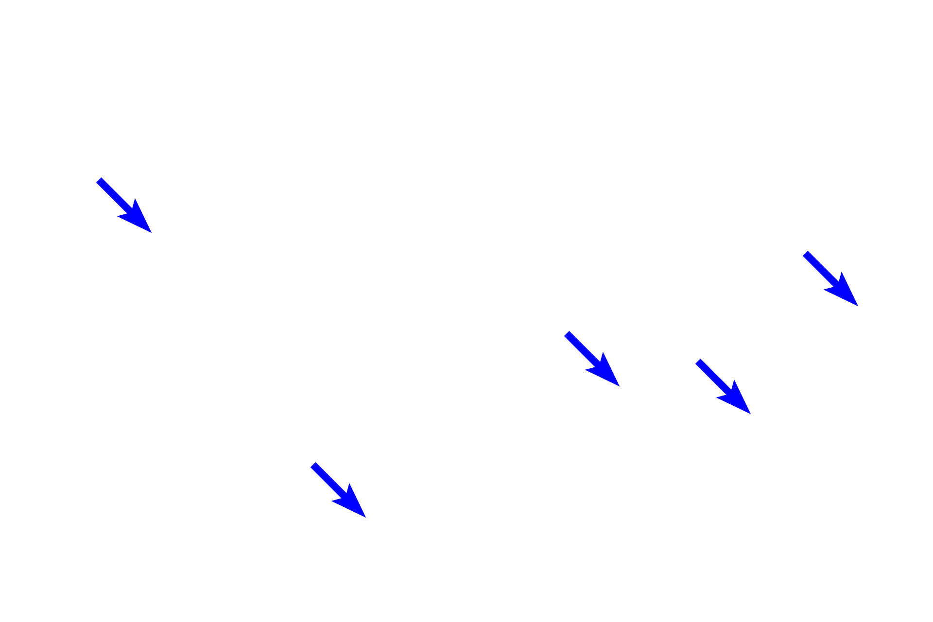 Cell bodies <p>Microglial cells function as macrophages in the CNS.  They have small, round to rod-shaped cell bodies with multiple, highly branched processes that are highly motile, continuously surveilling the surrounding tissue (left).  Trauma or infection causes these cells to enlarge as they actively become phagocytic and participate in the inflammatory process (right).  These sections are immunostained using an antibody for a macrophage-specific protein.  400x</p>
