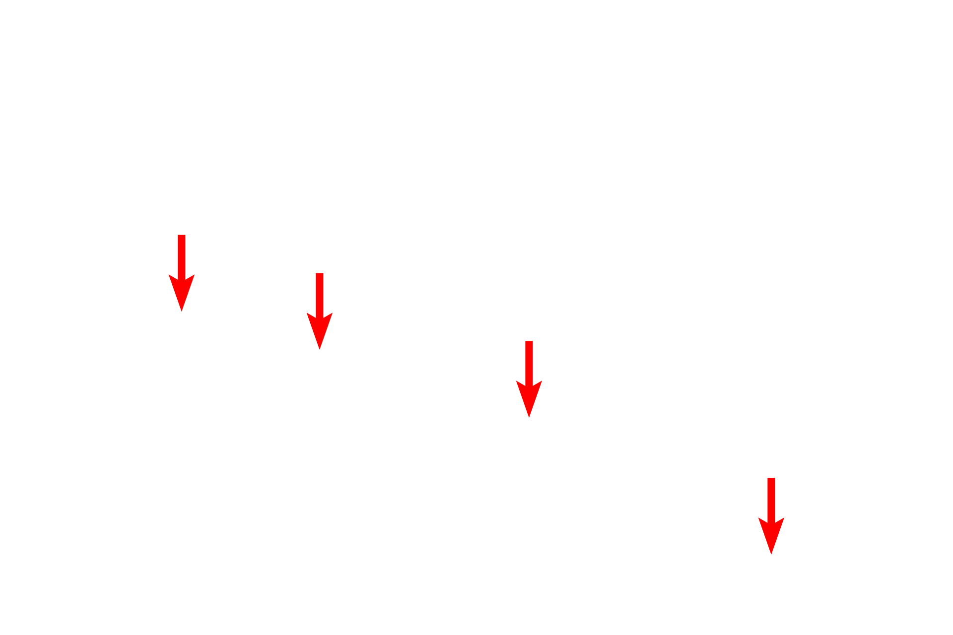 Ependymal cells <p>The ependyma consists of a low columnar, frequently ciliated, epithelium lining the ventricles and central canal of the CNS.  The cilia facilitate the movement of the cerebrospinal fluid (CSF) which occupies the spaces lined by the ependymal cells.  In some regions the ependyma is modified to form the choroid plexus which is highly folded and extends into the ventricle and produces the CSF.  The cells have a prominent brush border of microvilli.  1000x</p>
