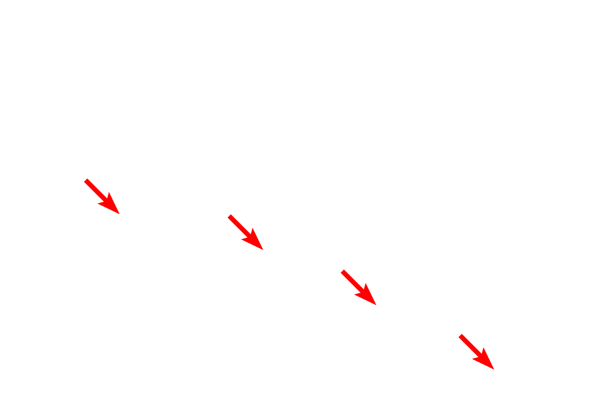  - Ependymal cell nuclei <p>The ependyma consists of a low columnar, frequently ciliated, epithelium lining the ventricles and central canal of the CNS.  The cilia facilitate the movement of the cerebrospinal fluid (CSF) which occupies the spaces lined by the ependymal cells.  In some regions the ependyma is modified to form the choroid plexus which is highly folded and extends into the ventricle and produces the CSF.  The cells have a prominent brush border of microvilli.  1000x</p>
