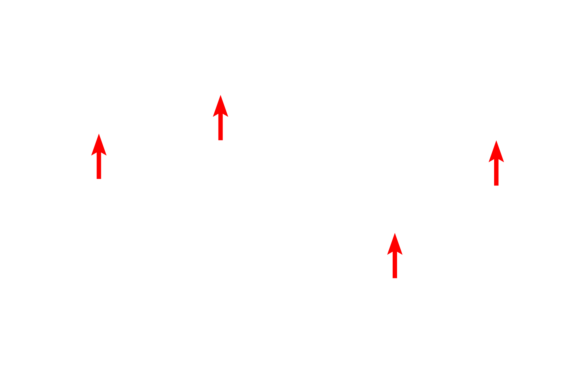 Choroid plexus cells <p>The ependyma consists of a low columnar, frequently ciliated, epithelium lining the ventricles and central canal of the CNS.  The cilia facilitate the movement of the cerebrospinal fluid (CSF) which occupies the spaces lined by the ependymal cells.  In some regions the ependyma is modified to form the choroid plexus which is highly folded and extends into the ventricle and produces the CSF.  The cells have a prominent brush border of microvilli.  1000x</p>
