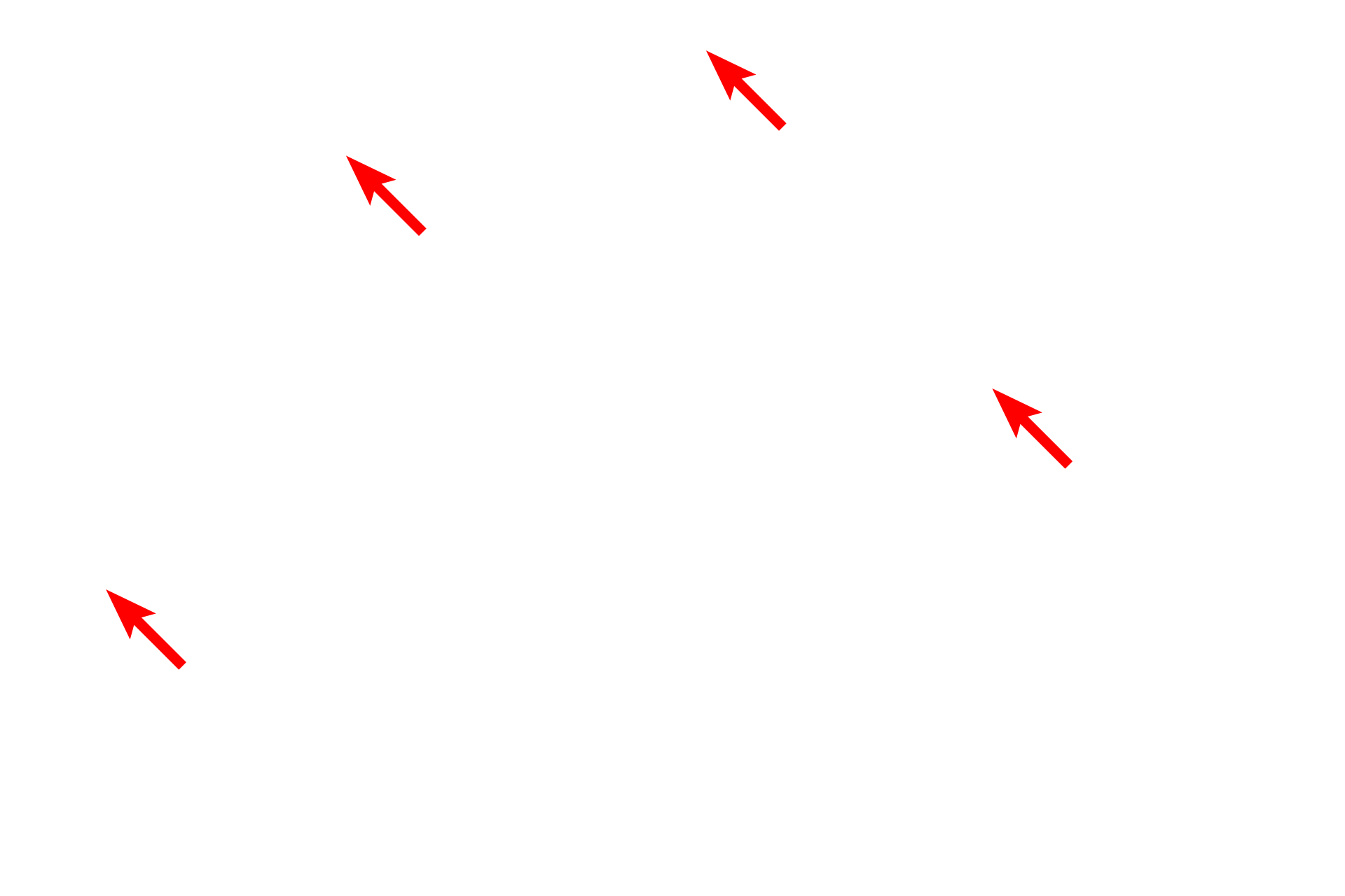 Capillaries <p>The ependyma consists of a low columnar, frequently ciliated, epithelium lining the ventricles and central canal of the CNS.  The cilia facilitate the movement of the cerebrospinal fluid (CSF) which occupies the spaces lined by the ependymal cells.  In some regions the ependyma is modified to form the choroid plexus which is highly folded and extends into the ventricle and produces the CSF.  The cells have a prominent brush border of microvilli.  1000x</p>
