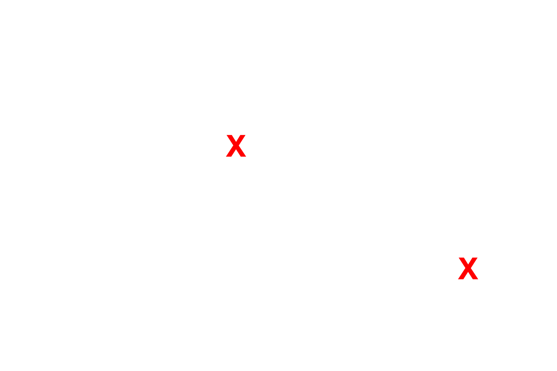 CSF space <p>The ependyma consists of a low columnar, frequently ciliated, epithelium lining the ventricles and central canal of the CNS.  The cilia facilitate the movement of the cerebrospinal fluid (CSF) which occupies the spaces lined by the ependymal cells.  In some regions the ependyma is modified to form the choroid plexus which is highly folded and extends into the ventricle and produces the CSF.  The cells have a prominent brush border of microvilli.  1000x</p>
