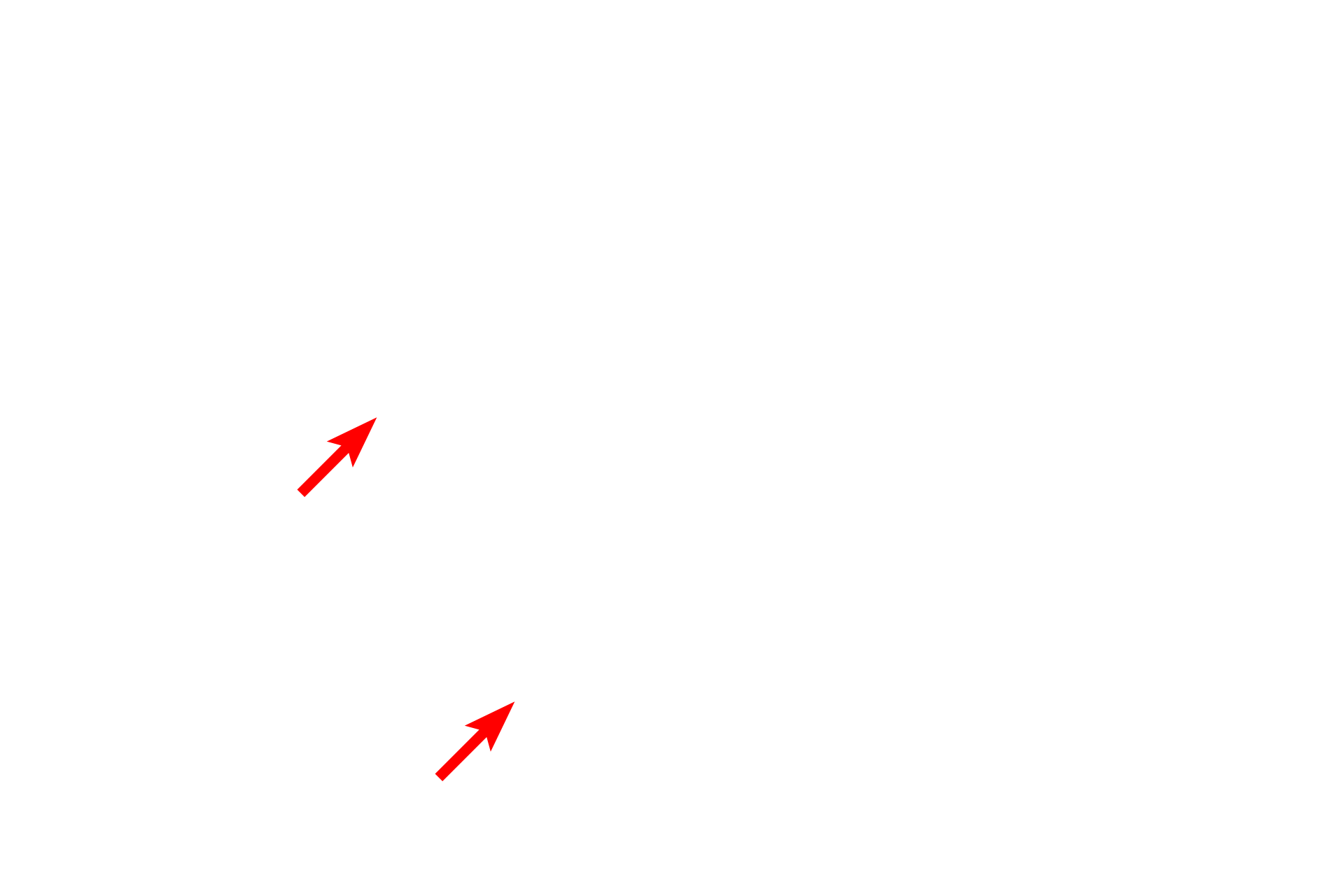 Non-myelinating Schwann cells <p>A second category of Schwann cells surrounds axons in peripheral nerves and consists of non-myelinating and myelinating types. Non-myelinating Schwann cells invest numerous small axons, with each axon aligning in a groove on the cell. Myelinating Schwann cells ensheath single axons with numerous spiraling wraps of membrane, forming a myelin segment or internode. A series of myelinating Schwann cells forms a segmented myelin sheath along a single axon. The myelin sheath is a lipid-rich, insulating wrapping of an axon, which increases the conduction velocity of an action potential. 1000x</p>
