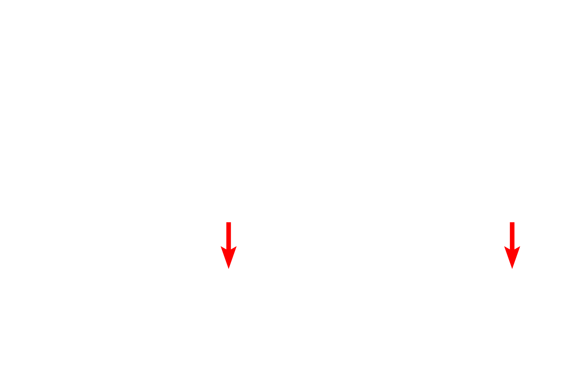 Myelinating Schwann cells <p>A second category of Schwann cells surrounds axons in peripheral nerves and consists of non-myelinating and myelinating types. Non-myelinating Schwann cells invest numerous small axons, with each axon aligning in a groove on the cell. Myelinating Schwann cells ensheath single axons with numerous spiraling wraps of membrane, forming a myelin segment or internode. A series of myelinating Schwann cells forms a segmented myelin sheath along a single axon. The myelin sheath is a lipid-rich, insulating wrapping of an axon, which increases the conduction velocity of an action potential. 1000x</p>
