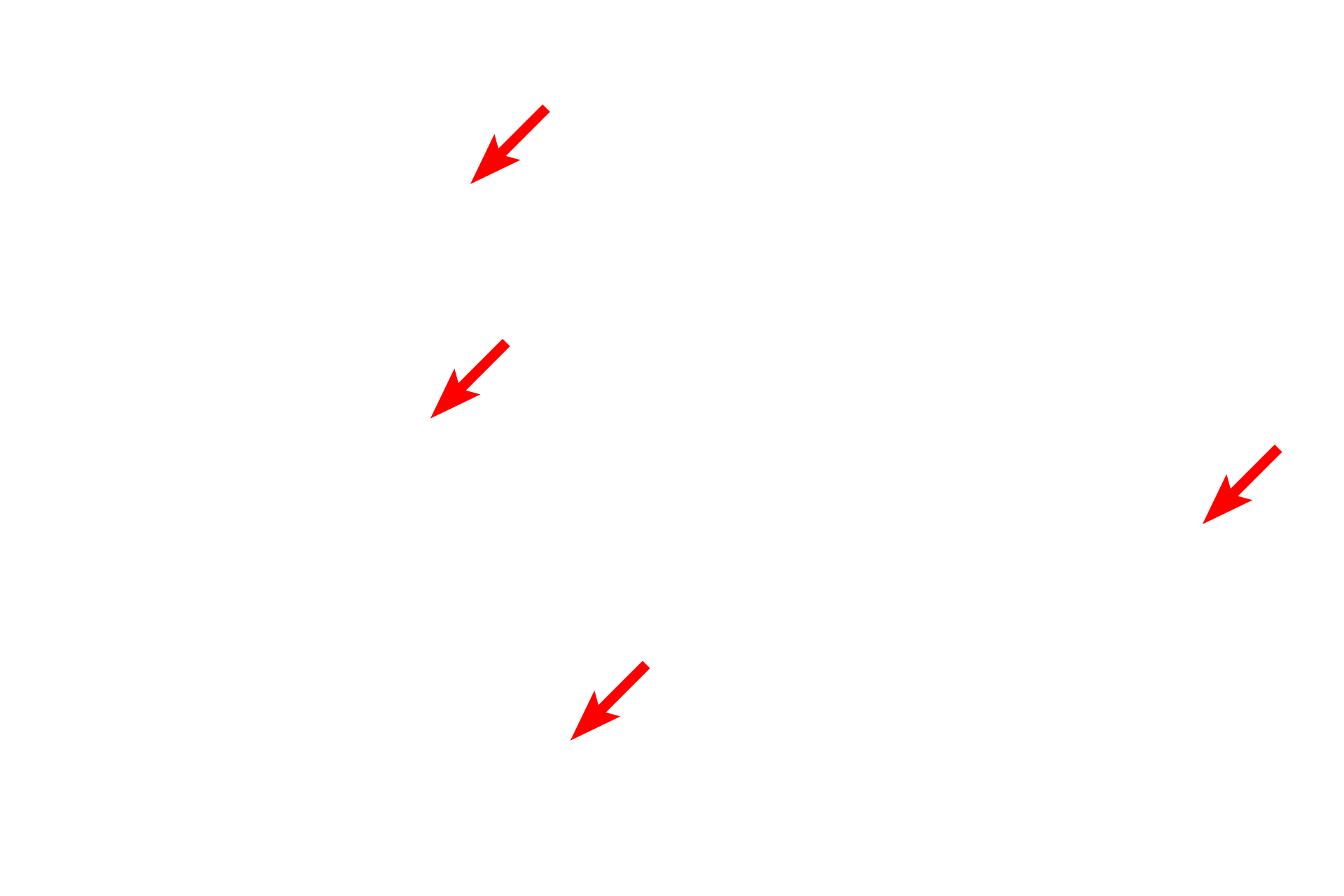 Unmyelinated axons <p>A second category of Schwann cells surrounds axons in peripheral nerves and consists of non-myelinating and myelinating types. Non-myelinating Schwann cells invest numerous small axons, with each axon aligning in a groove on the cell. Myelinating Schwann cells ensheath single axons with numerous spiraling wraps of membrane, forming a myelin segment or internode. A series of myelinating Schwann cells forms a segmented myelin sheath along a single axon. The myelin sheath is a lipid-rich, insulating wrapping of an axon, which increases the conduction velocity of an action potential. 1000x</p>
