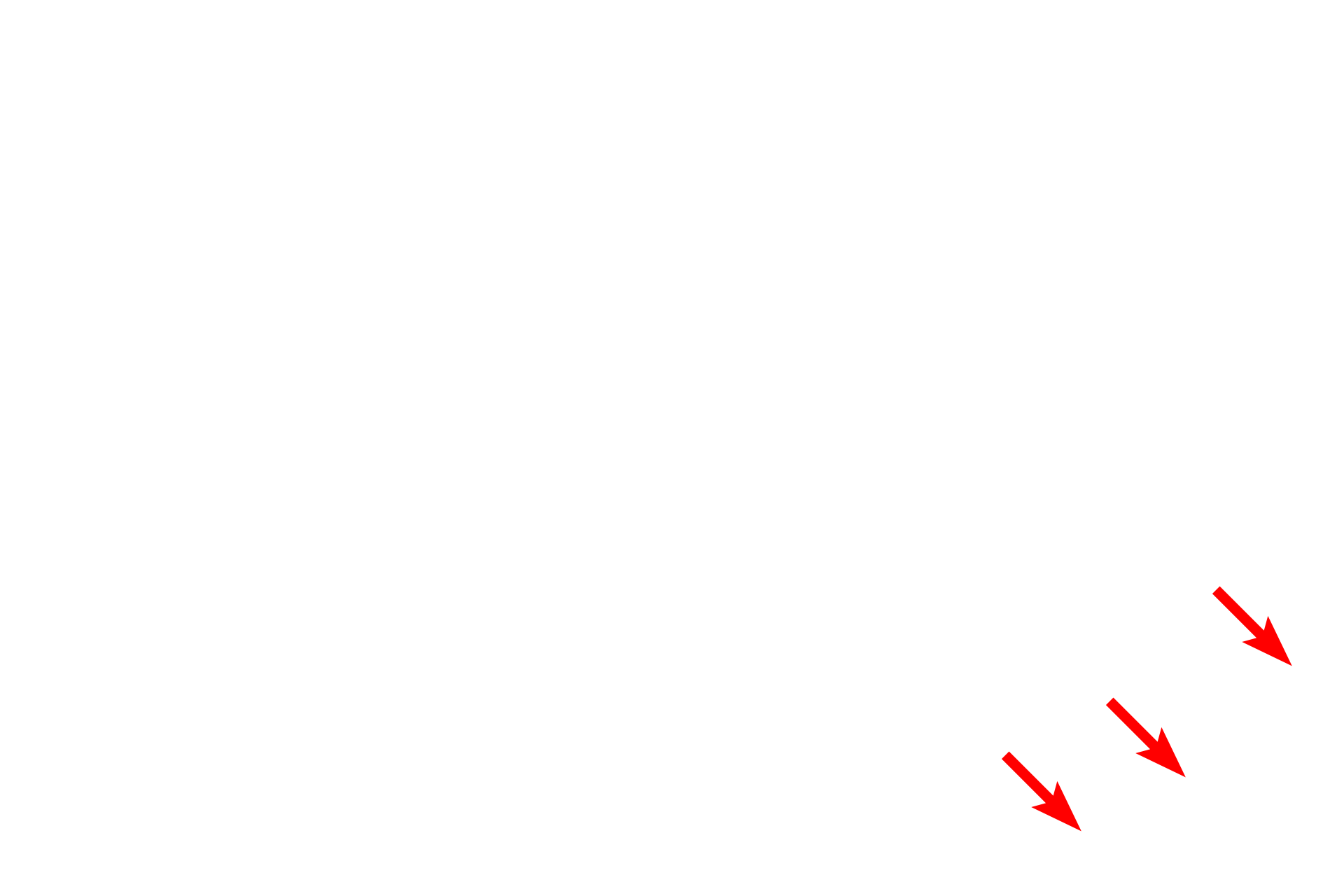Unmyelinated axons <p>The external lamina is secreted by the Schwann cell and is similar in structure and composition to the basal lamina in epithelial tissues.  The external lamina provides anchorage for the Schwann cell, particularly during the myelination process.  The endoneurium is product of fibroblasts in the peripheral nerve and contains collagen fibrils.</p>
