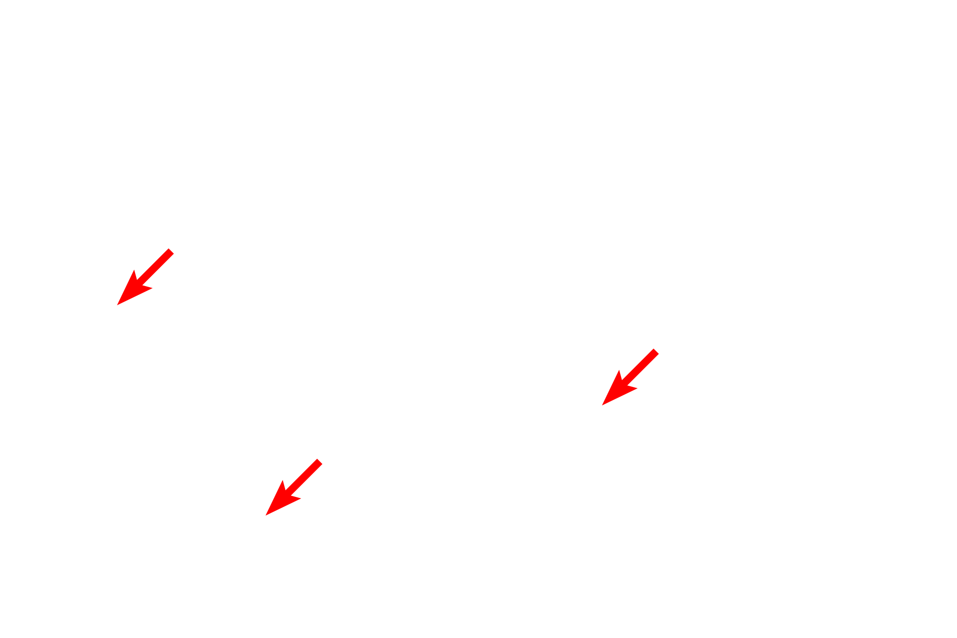 Myelin sheath <p>A myelinated axon is shown in cross section in this electron micrograph.  Especially prominent in axons are microtubules and neurofilaments.  Schwann cell cytoplasm and  the external lamina of the Schwann cell surround the myelin.  40,000x</p>
