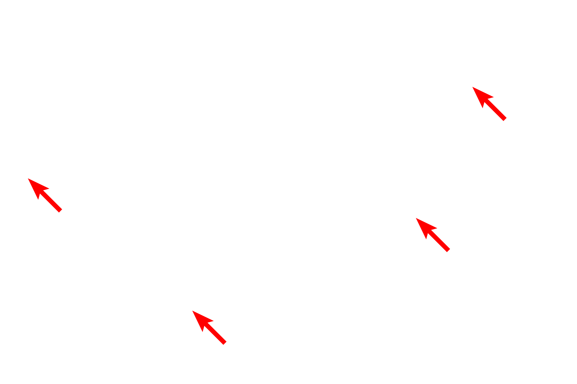 External lamina <p>A myelinated axon is shown in cross section in this electron micrograph.  Especially prominent in axons are microtubules and neurofilaments.  Schwann cell cytoplasm and  the external lamina of the Schwann cell surround the myelin.  40,000x</p>
