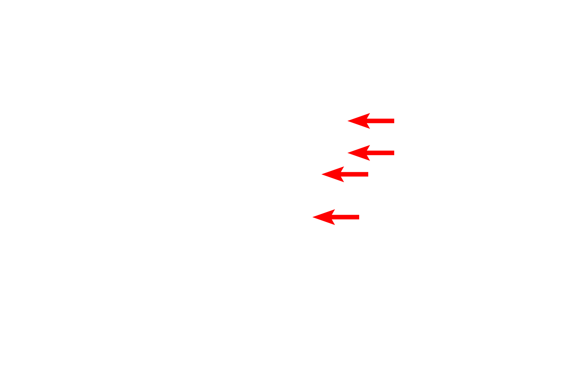 Neurofilaments and microtubles <p>A freeze fracture electron micrograph shows an axon and its myelin sheath, fractured transversely.  This axon is surrounded by 10-15 wrappings of myelin derived from Schwann cell plasma membrane.  Visible in the axon are numerous small bumps representing microtubules.  Portions of uncompacted Schwann cell cytoplasm are also visible.  60,000x</p>
