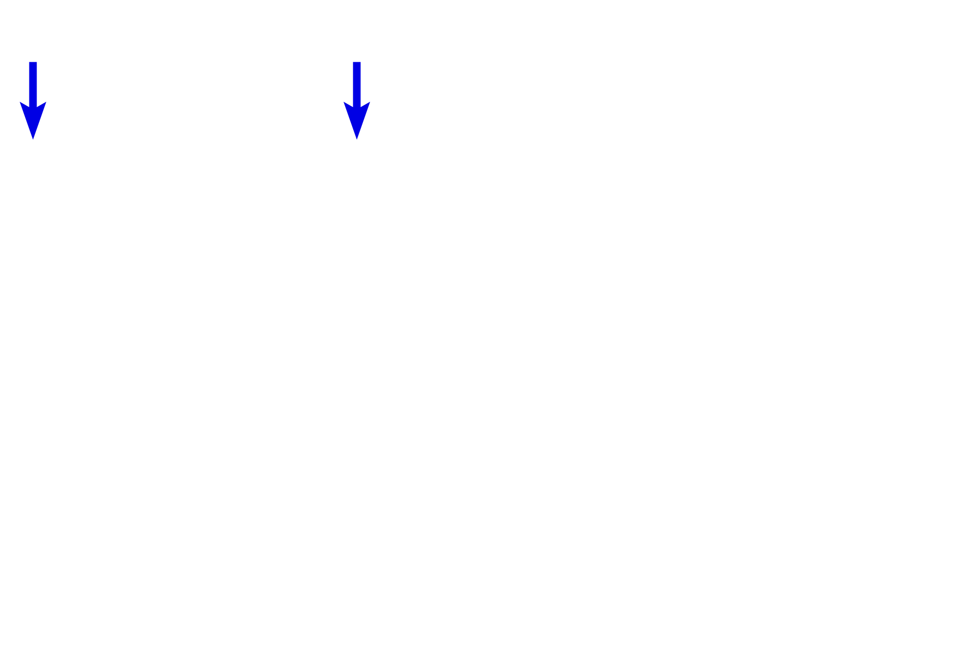 Dorsal root ganglia > <p>A dorsal root ganglion is located on either site of the spinal cord and contains a collection of pseudounipolar neurons.  The neurons have a peripheral process that enters the ganglion from the periphery via the spinal nerve.  The central process of the cell forms the dorsal root and extends into the spinal cord.</p>
