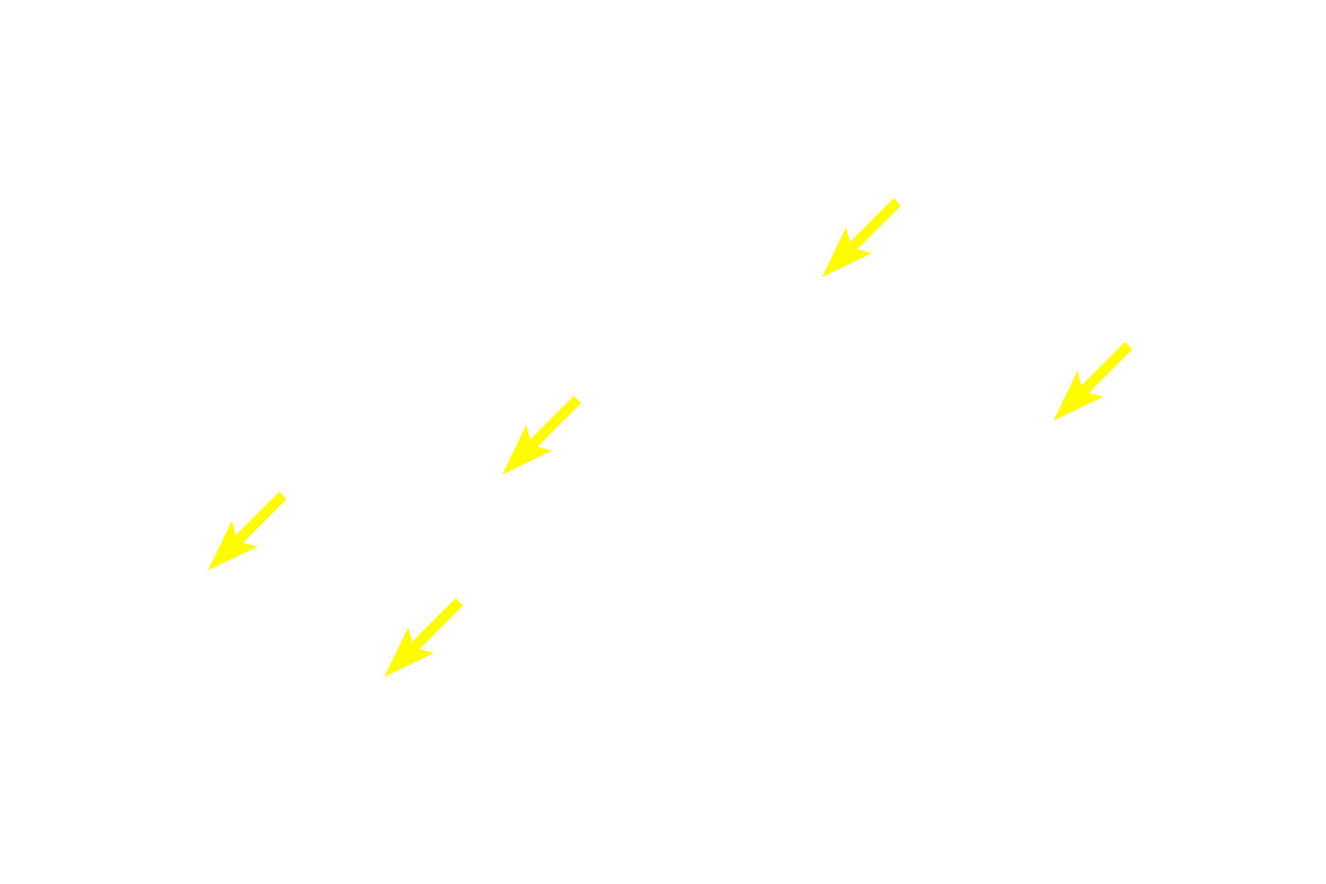 Pseudounipolar neurons > <p>Pseudounipolar neurons, exclusively sensory in function, are found almost entirely in the peripheral nervous system.  The cell body has a single process that divides near the cell body into a peripheral and a central process, both of which resemble an axon.  The peripheral process carries sensory stimuli from the periphery, which by-pass the cell body and continue into the spinal cord.</p>
