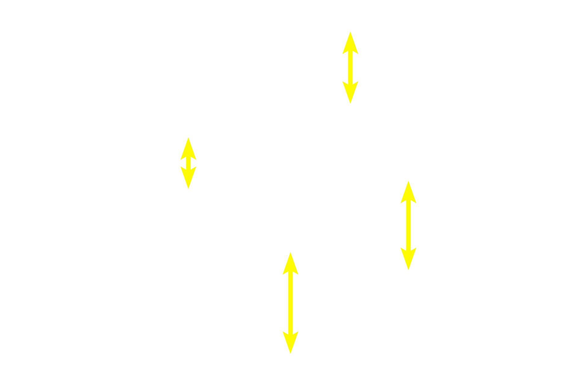 Neuronal cell bodies <p>Several pseudounipolar neurons are seen in this image.  Pseudounipolar neuron cell bodies vary in size, a feature that correlates with the type of sensory information each neuron conveys.  Each cell body is surrounded by satellite Schwann cells which form a capsule.  750x</p>
