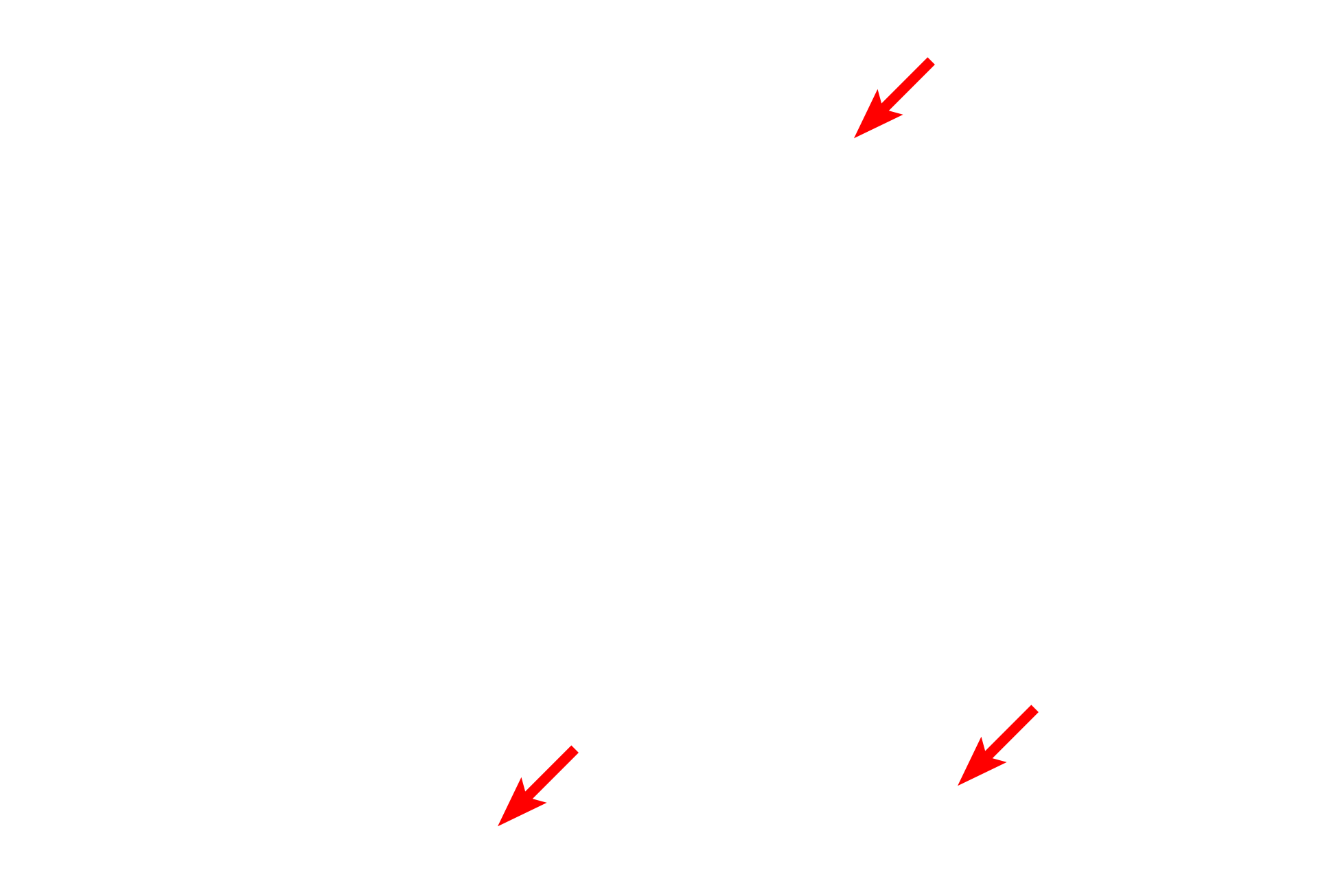 Bone <p>Bipolar neurons in the adult are found in organs of special sense, such as the cochlea of the inner ear, shown here.  A dendrite originates in the organ of Corti (receptor for hearing) and extends to the cell body of a bipolar neuron in the spiral ganglion.  From the opposite pole of that cell body, an axon emerges to form the cochlear division of cranial nerve VIII.  200x</p>
