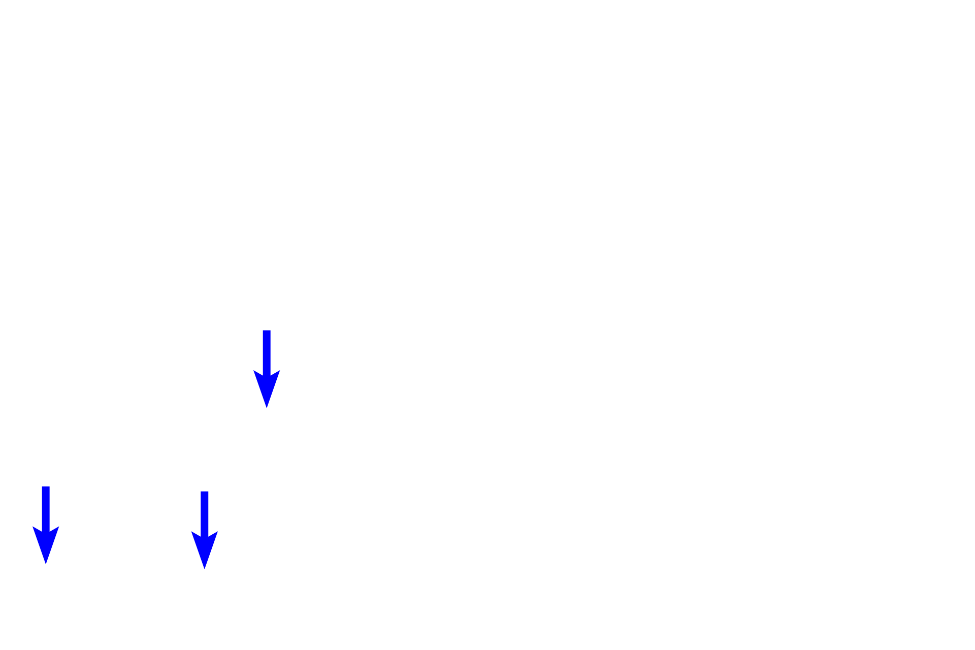 Dendrites <p>A dendrite originates in the organ of Corti and extends to a bipolar, neuronal cell body located in this spiral ganglion.  From the opposite pole of the cell body, an axon emerges which will join other axons to form the cochlear division of cranial nerve VIII.  Ensheathing Schwann cells can also be seen accompanying both processes.  400x</p>
