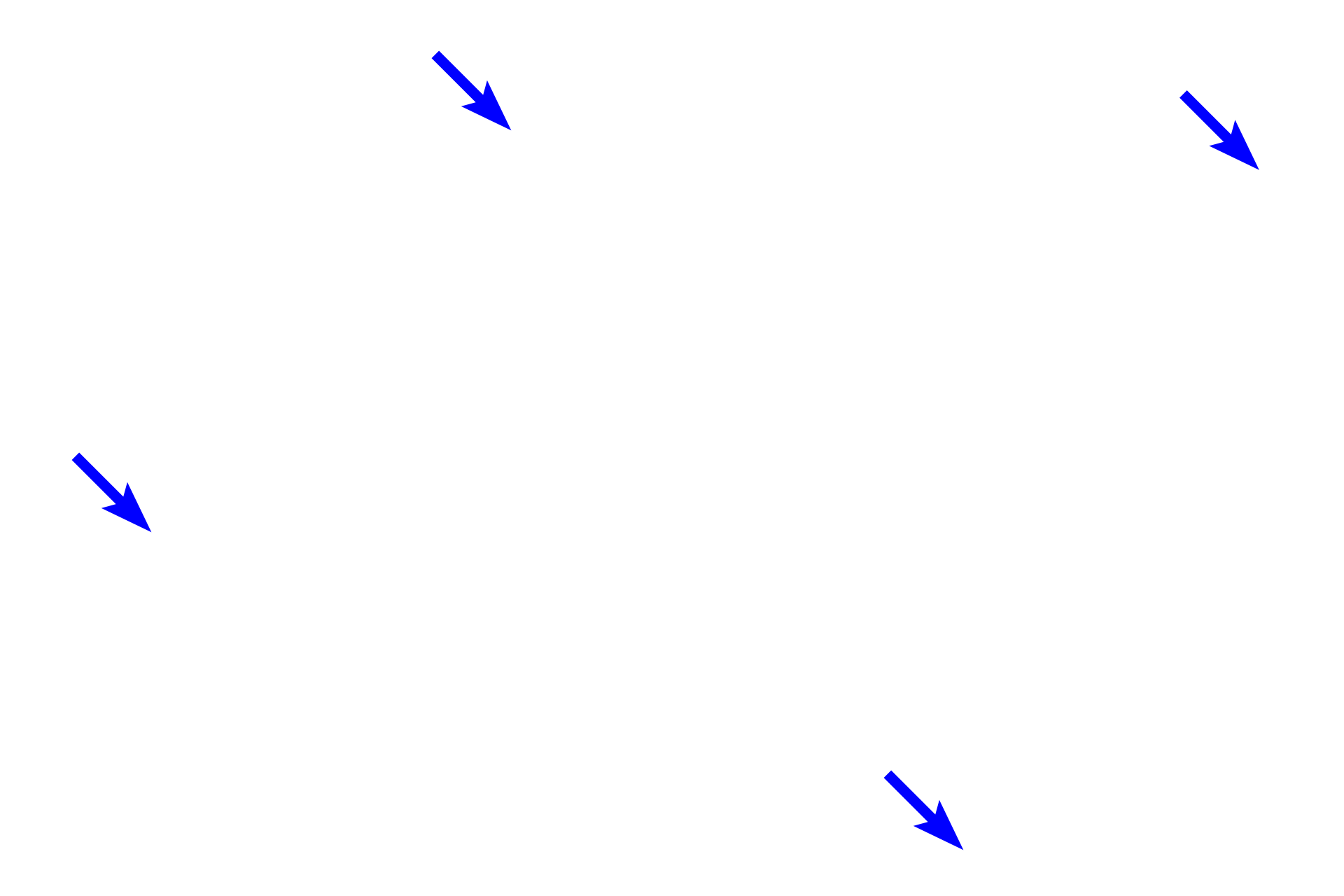 Bone <p>A dendrite originates in the organ of Corti and extends to a bipolar, neuronal cell body located in this spiral ganglion.  From the opposite pole of the cell body, an axon emerges which will join other axons to form the cochlear division of cranial nerve VIII.  Ensheathing Schwann cells can also be seen accompanying both processes.  400x</p>
