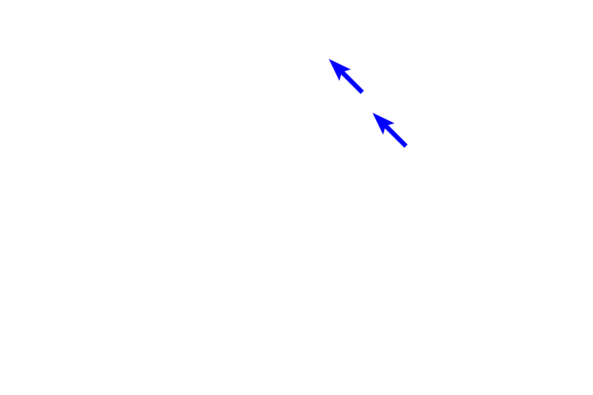 Schwann cell nuclei <p>In most cases, special sensory stimuli are transduced by receptor cells and the signal is carried by a dendrite toward the cell body.  An axon leaves the cell body from its opposite pole to form a cranial nerve that enters the brain.  Axonal and dendritic processes cannot be differentiated in this image.  Vestibular ganglion of the ear  1200x</p>

