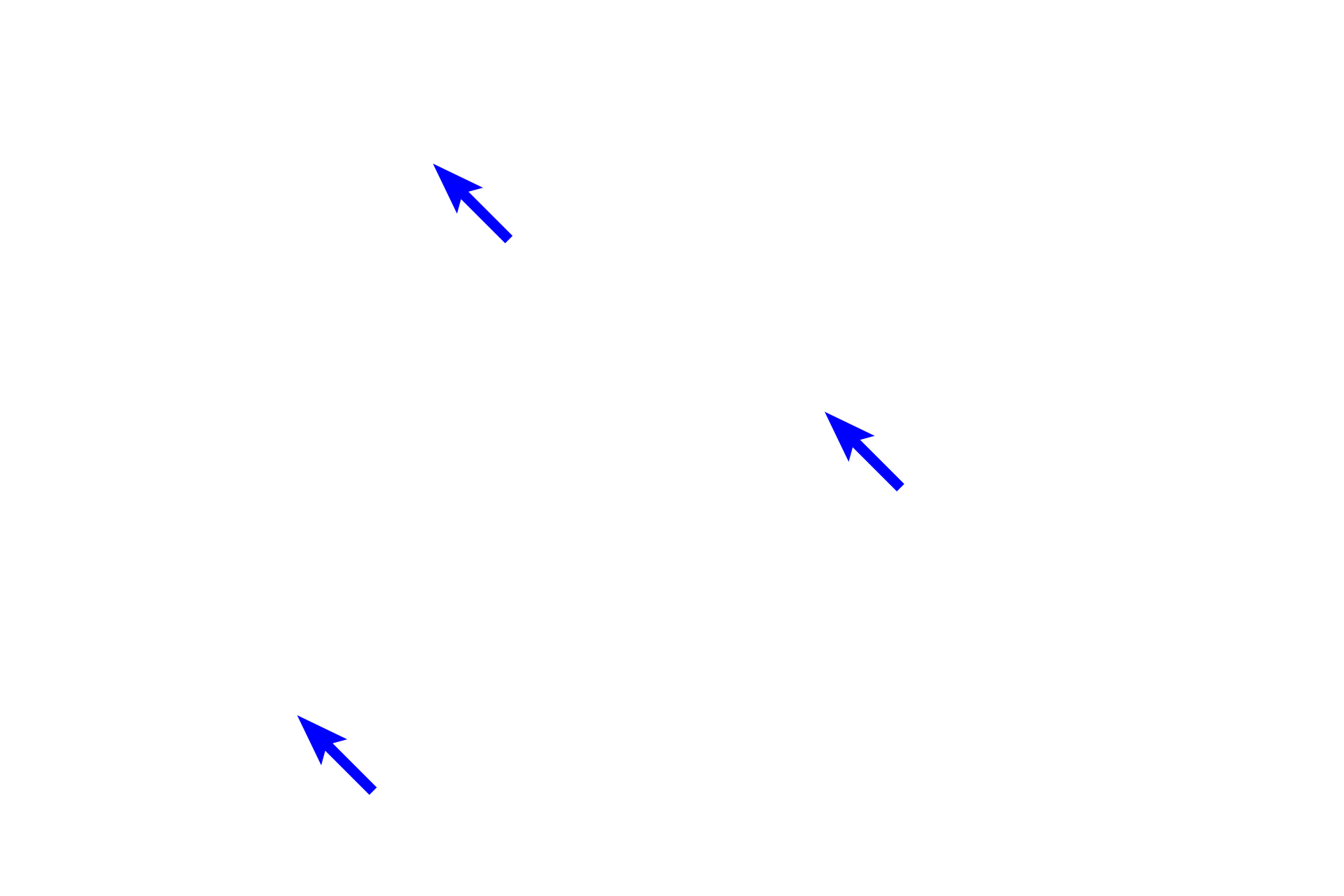 Capillaries <p>In most cases, special sensory stimuli are transduced by receptor cells and the signal is carried by a dendrite toward the cell body.  An axon leaves the cell body from its opposite pole to form a cranial nerve that enters the brain.  Axonal and dendritic processes cannot be differentiated in this image.  Vestibular ganglion of the ear  1200x</p>

