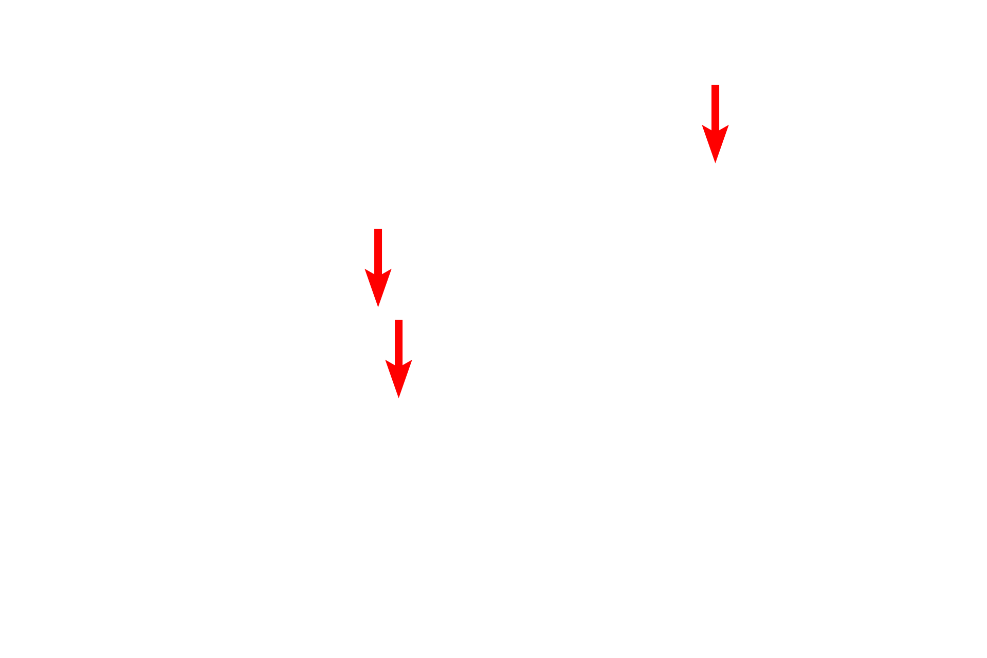 Nissl substance > <p>Nissl substance is an accumulation of RER and polysomes in neuronal cell bodies and dendrites.  The presence of Nissl is one characteristic of dendrites which discriminates them from axons.</p>
