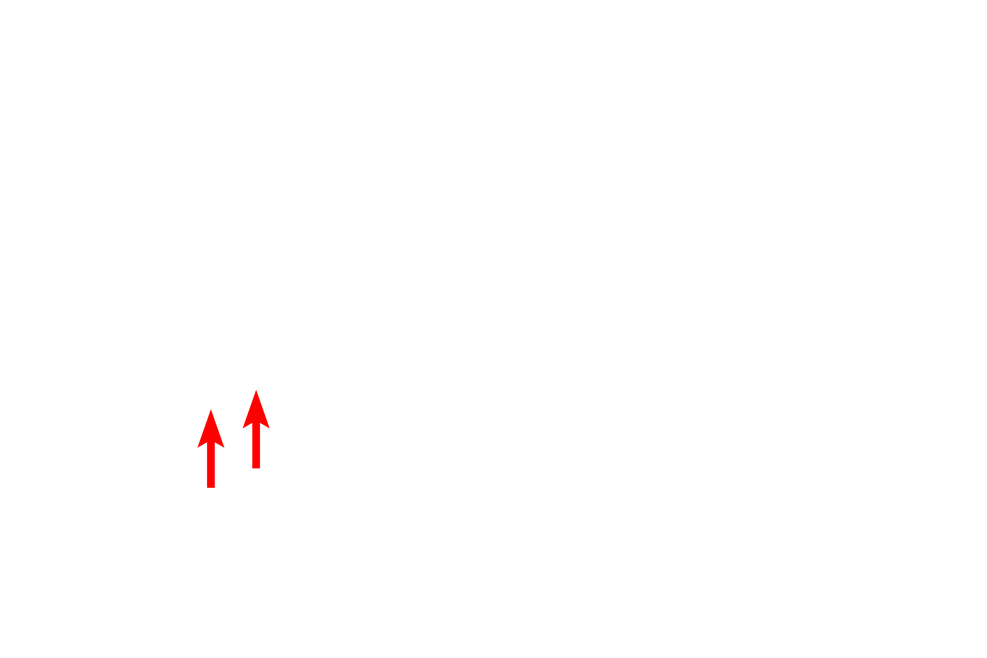 Axon > <p>The axon is a singular process that conducts the action potential.  It lacks Nissl and originates from the cell body at the axon hillock.  The first portion of the axon is the initial segment which is rich in sodium channels and is the initiation site for the action potential.  </p>
