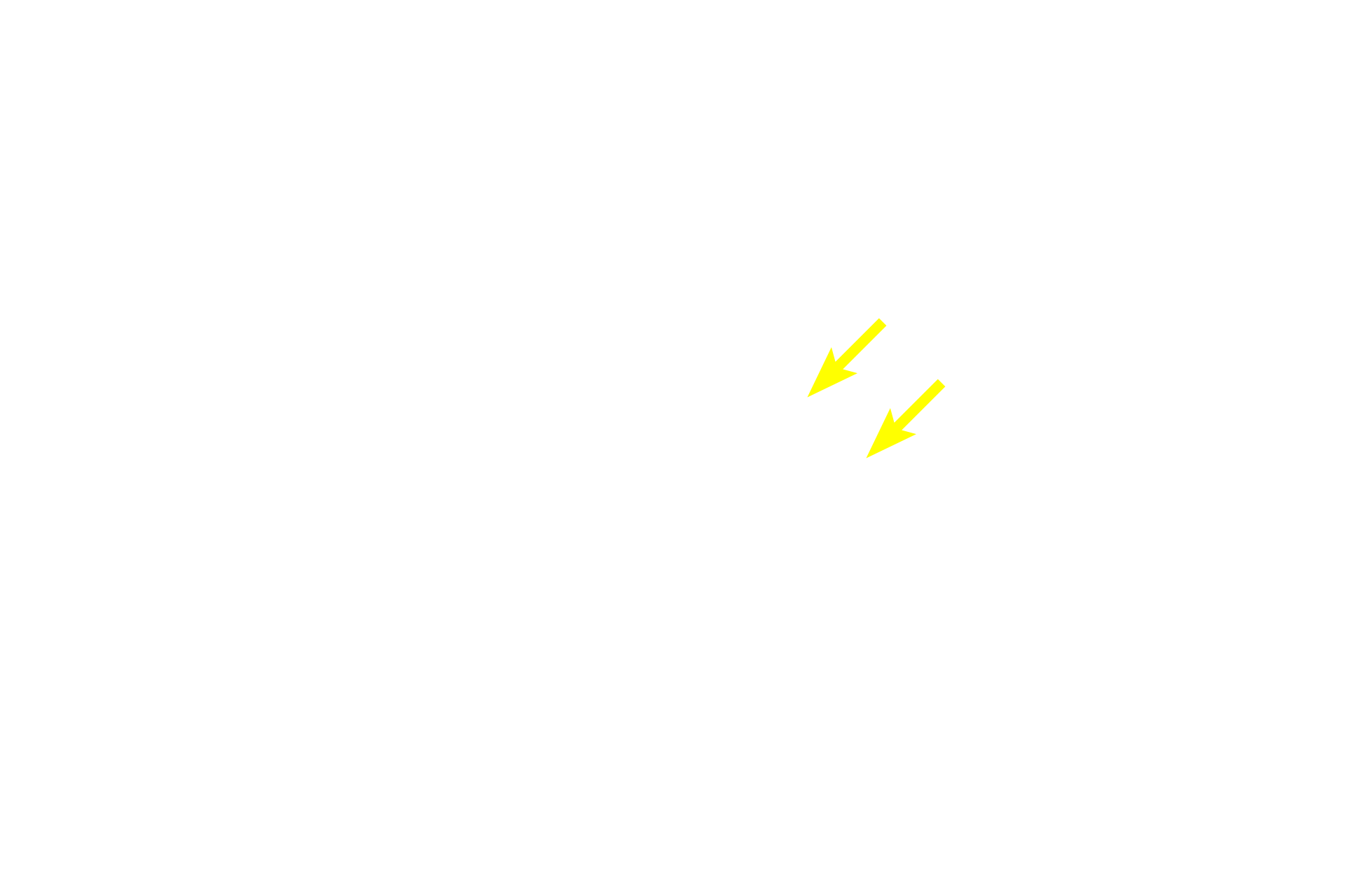 Nucleus <p>The nucleus, nucleolus and Nissl substance (RER and polysomes) are located in the cell body of a neuron.  Also seen are two dendrites and an axon, the latter of which lacks RER.  The space around the cell body is a common artifact of nervous tissue.  Numerous glial cell nuclei are also present.  1000x</p>
