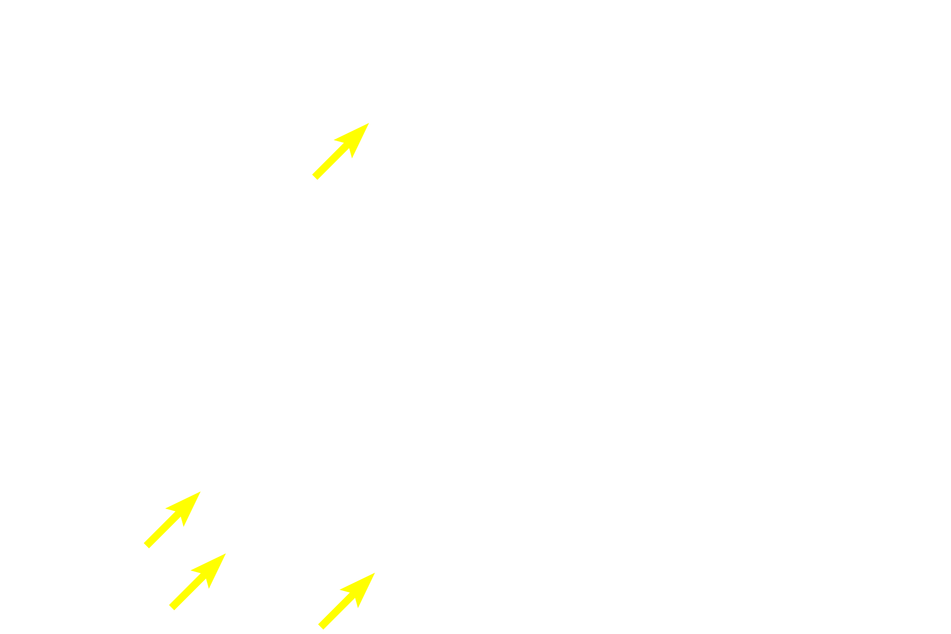 Glial cell nuclei <p>The nucleus, nucleolus and Nissl substance (RER and polysomes) are located in the cell body of a neuron.  Also seen are two dendrites and an axon, the latter of which lacks RER.  The space around the cell body is a common artifact of nervous tissue.  Numerous glial cell nuclei are also present.  1000x</p>
