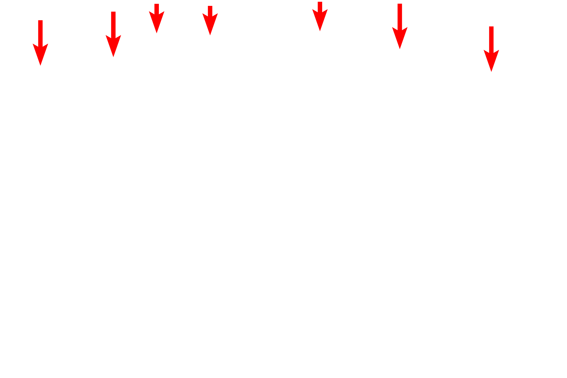 Neuronal plasma membrane <p>This electron micrograph shows a portion of a neuronal cell body with a large Nissl body.  Nissl is a unique association of RER and polyribosomes which appear as discrete structures in the cytoplasm.  Nissl is prominent in the cell body and dendrites but is absent from axons.</p>
