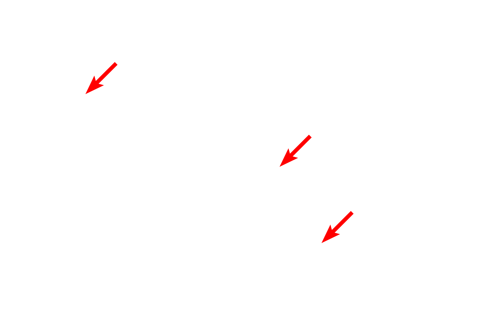 Multipolar neurons <p>These multipolar neurons in the brainstem are interspersed with myelinated axons and glial cells.  Although these are multipolar neurons, not all of their processes appear in a single plane of section.  Numerous glial cells surround the neurons.  400x</p>
