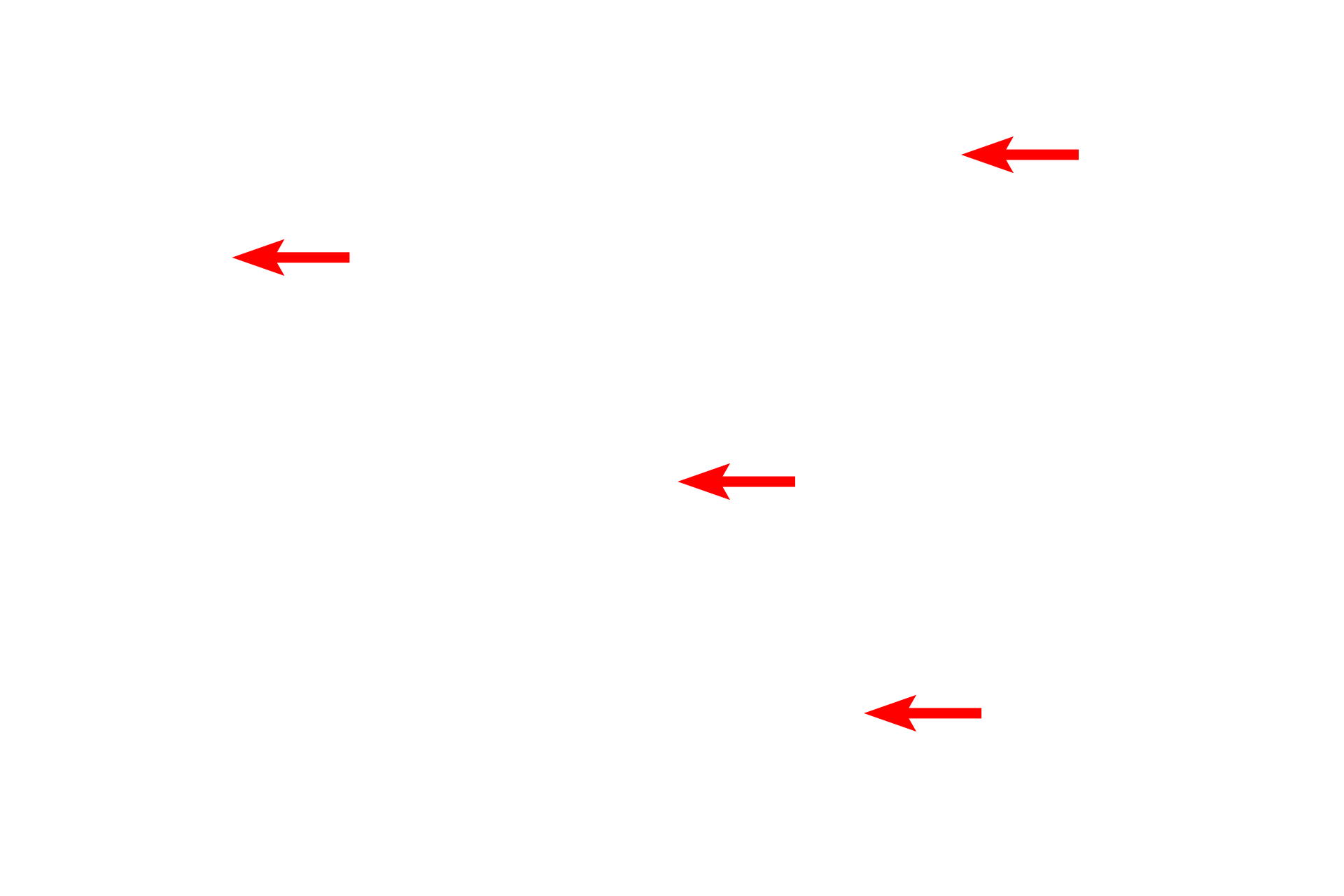 Nissl substance <p>These multipolar neurons in the brainstem are interspersed with myelinated axons and glial cells.  Although these are multipolar neurons, not all of their processes appear in a single plane of section.  Numerous glial cells surround the neurons.  400x</p>
