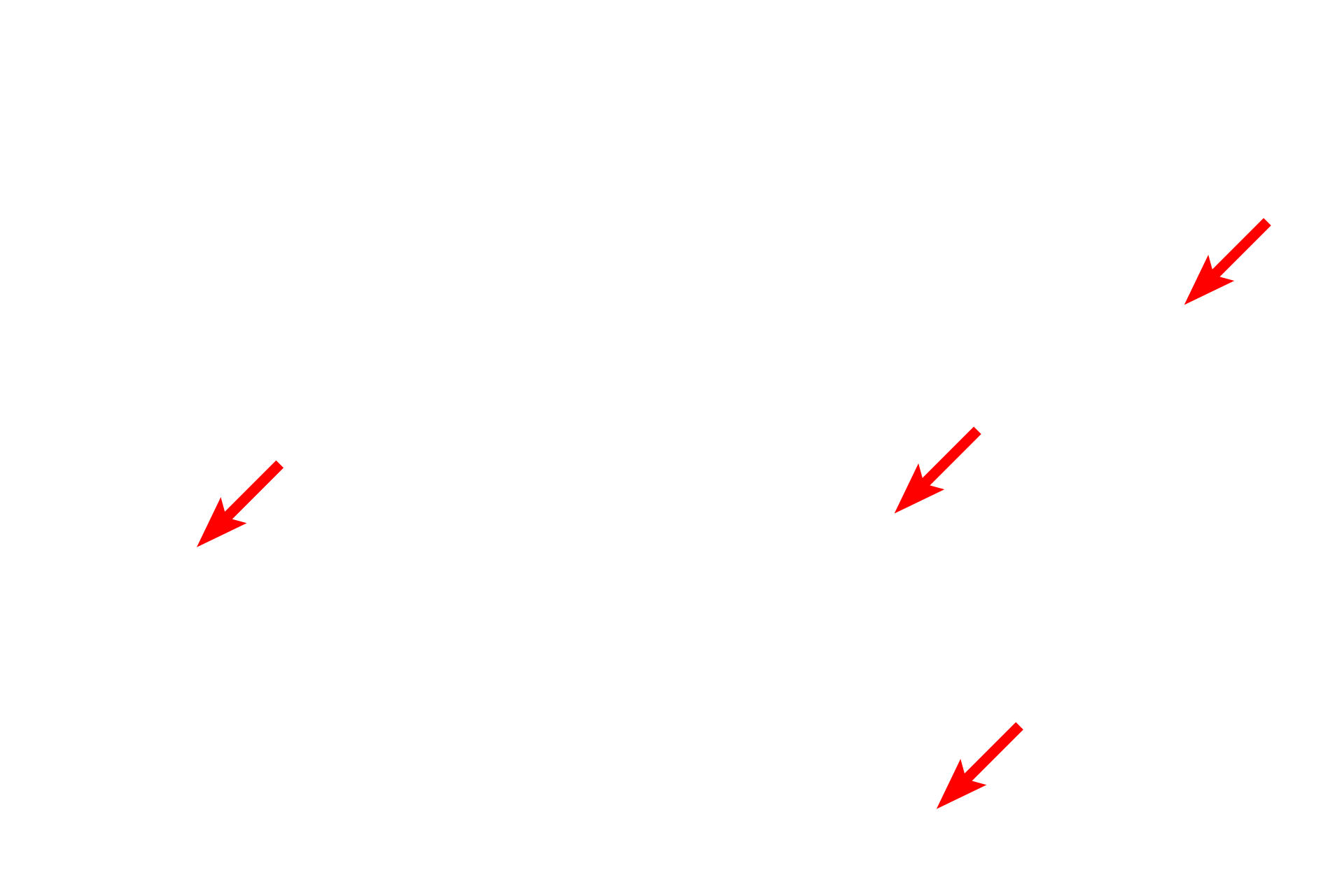 Myelin sheaths <p>These multipolar neurons in the brainstem are interspersed with myelinated axons and glial cells.  Although these are multipolar neurons, not all of their processes appear in a single plane of section.  Numerous glial cells surround the neurons.  400x</p>
