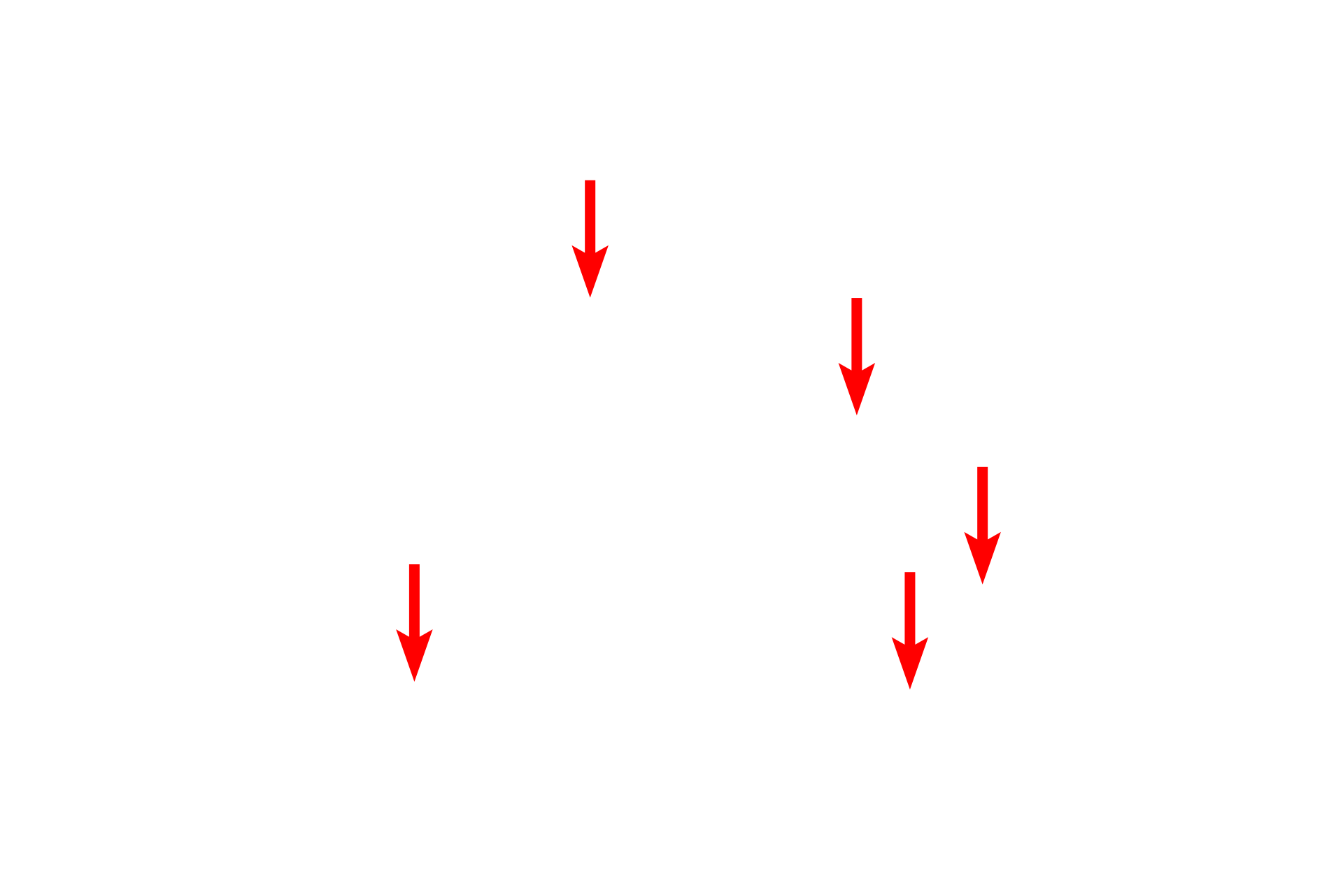 Glial cell nuclei <p>These multipolar neurons in the brainstem are interspersed with myelinated axons and glial cells.  Although these are multipolar neurons, not all of their processes appear in a single plane of section.  Numerous glial cells surround the neurons.  400x</p>
