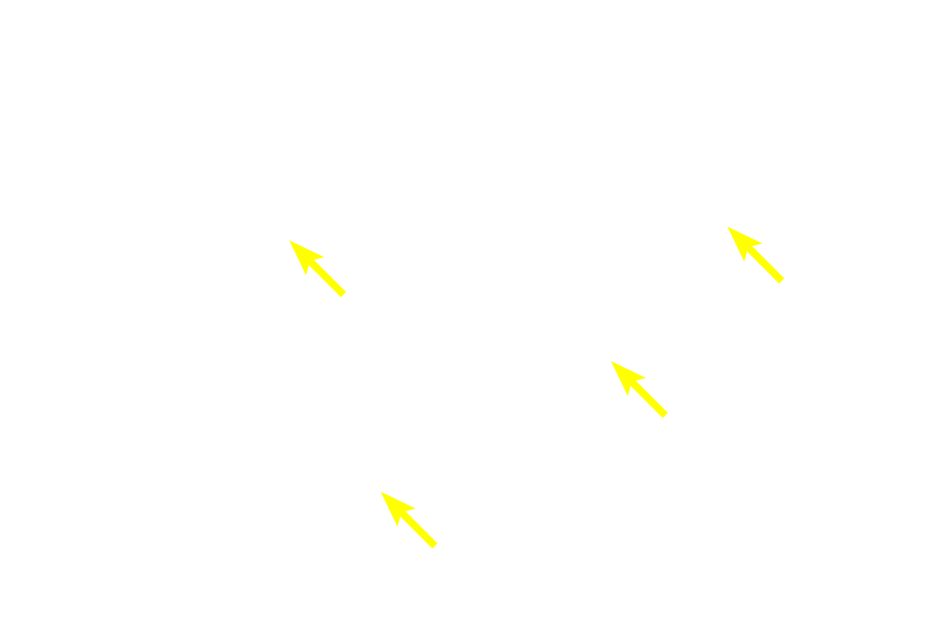  - Intralobular connective tissue and ducts <p>Most compound glands are macroscopic organs surrounded by a connective tissue capsule. Partitions arising from the capsule subdivide the gland into lobules composed of secretory acini (alveoli) and/or tubules. Secretions from the lobules are drained by a complex, branching, duct system. Most compound glands are associated with the digestive system. Parotid gland 10x</p>
