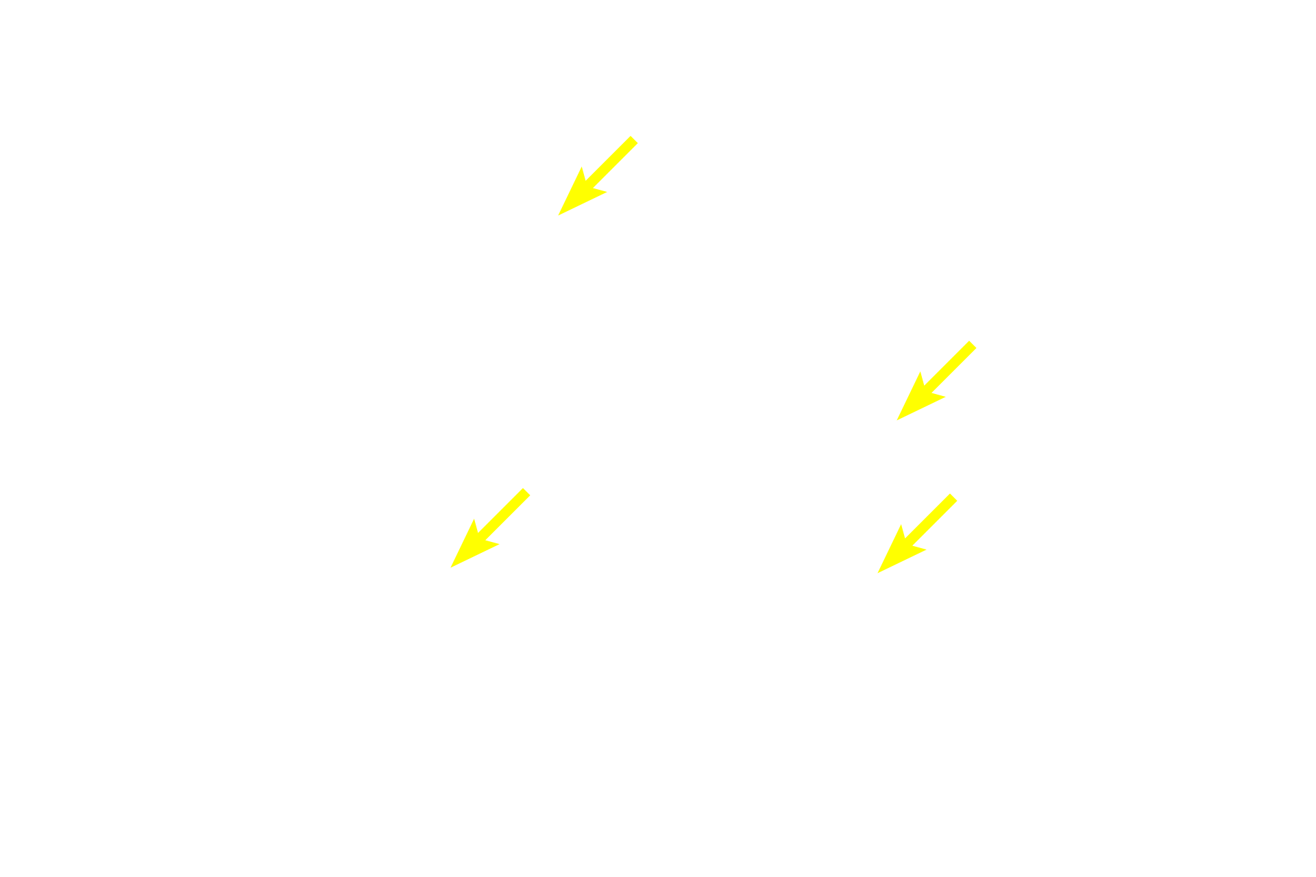 Interlobular connective tissue <p>Most compound glands are macroscopic organs surrounded by a connective tissue capsule. Partitions arising from the capsule subdivide the gland into lobules composed of secretory acini (alveoli) and/or tubules. Secretions from the lobules are drained by a complex, branching, duct system. Most compound glands are associated with the digestive system. Parotid gland 10x</p>
