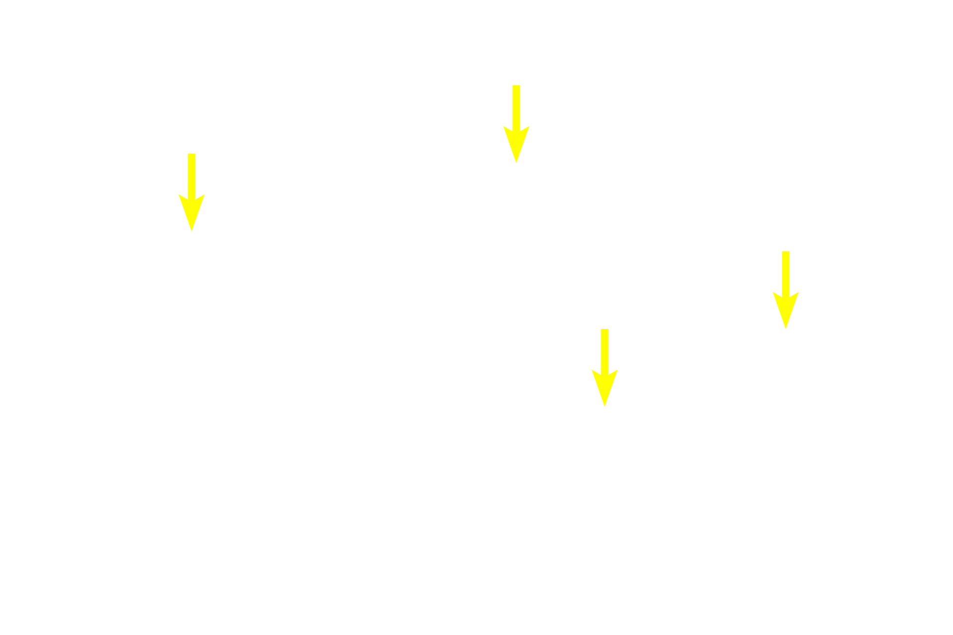 Interlobular ducts <p>Most compound glands are macroscopic organs surrounded by a connective tissue capsule. Partitions arising from the capsule subdivide the gland into lobules composed of secretory acini (alveoli) and/or tubules. Secretions from the lobules are drained by a complex, branching, duct system. Most compound glands are associated with the digestive system. Parotid gland 10x</p>
