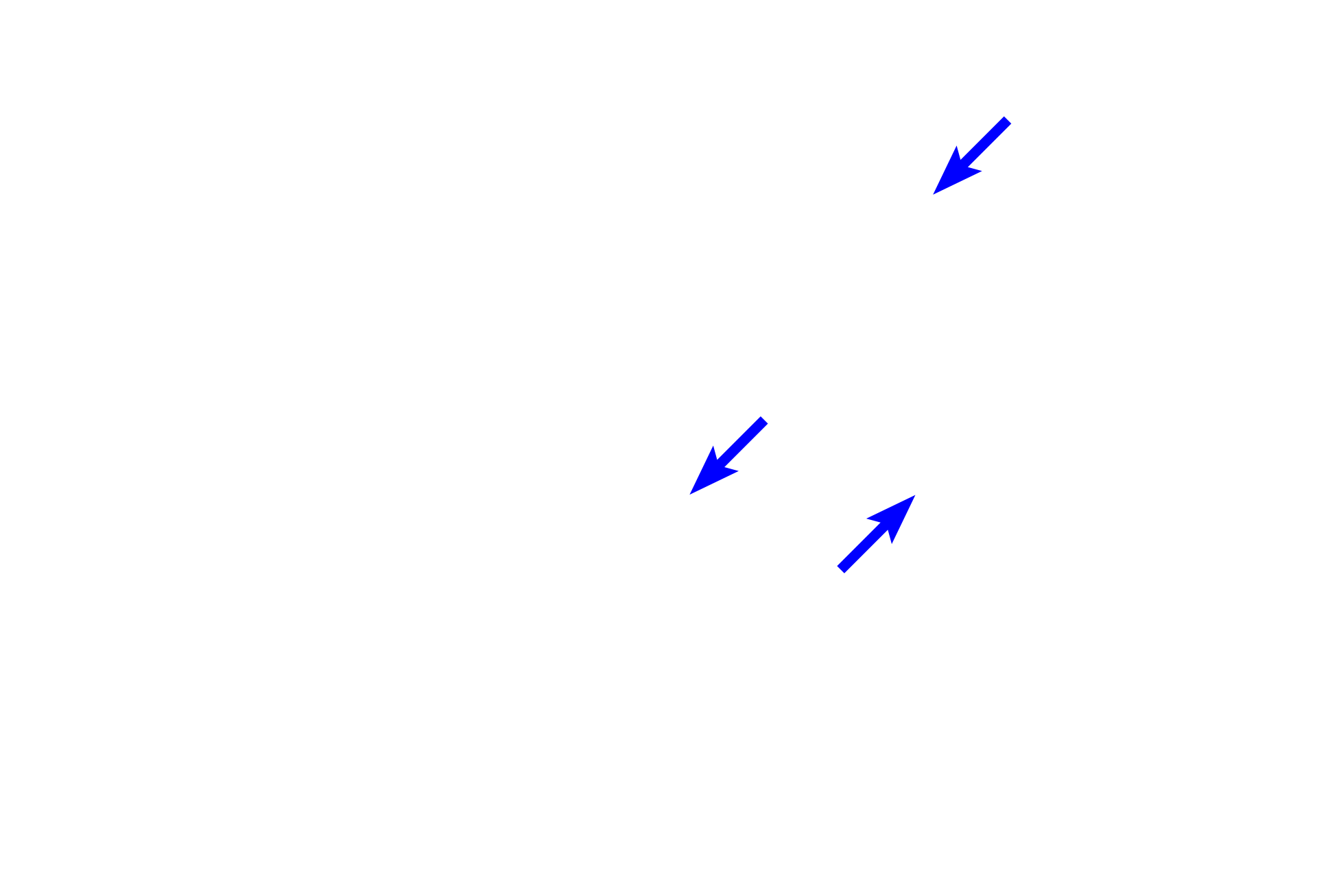  - Nuclei of acinar cells <p>Compound acinar glands demonstrate polarity.  The base of each cell contains its nucleus and RER.  Secretory granules accumulate in the apical portions of the acinar cells, and their contents are released by the merocrine mode of secretion into the acinar lumen.  Pancreas 1200x</p>
