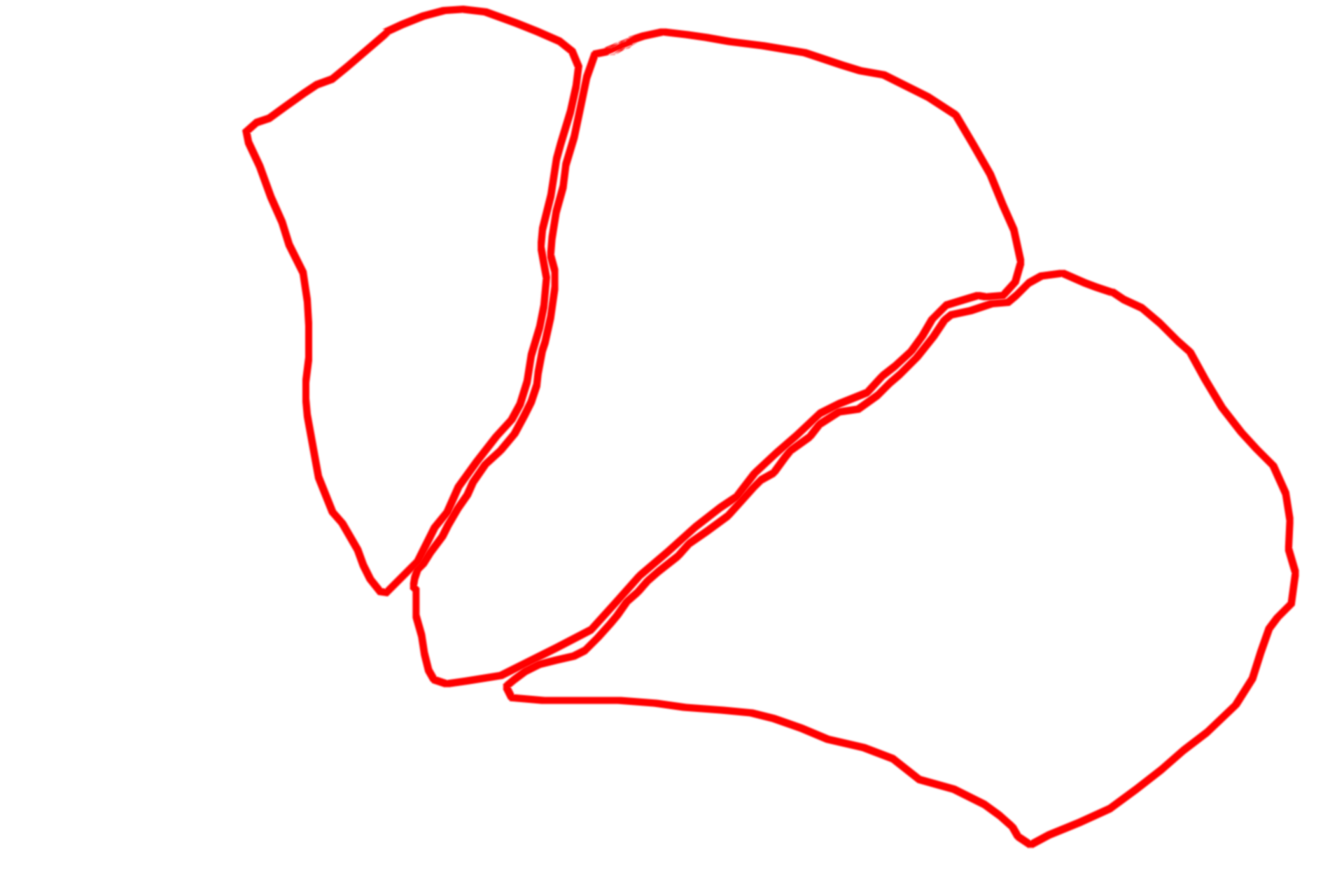 Acinar cells <p>This electron micrograph shows an acinus from a compound acinar gland.  These highly polarized cells show prominent, basally located RER and numerous apical secretory granules.  The granules contain digestive enzymes which are secreted by the merocrine mode of secretion into the central lumen of the acinus.  Pancreas  3000x</p>
