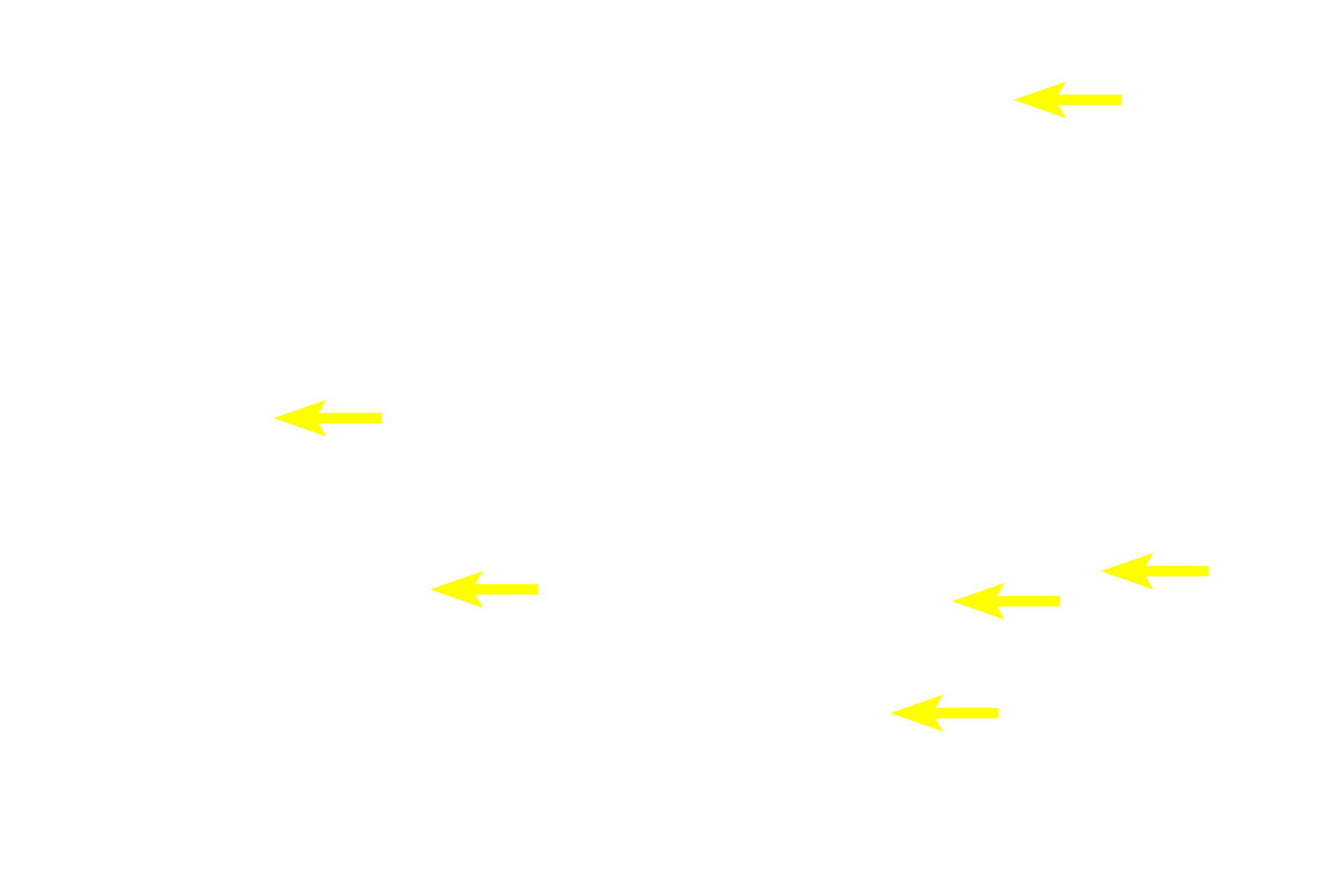  - Intralobular ducts <p>A compound, tubuloacinar gland consists of both tubular and acinar secretory units and the gland is subdivided by connective tissue into lobules   Draining the secretory units are intralobular ducts, which are contained entirely within the lobule.  Interlobular ducts are located in the interlobular connective tissue and drain multiple lobules.  This gland is the submandibular (submaxillary) gland which is one of the major salivary glands.  Submandibular gland  40x</p>
