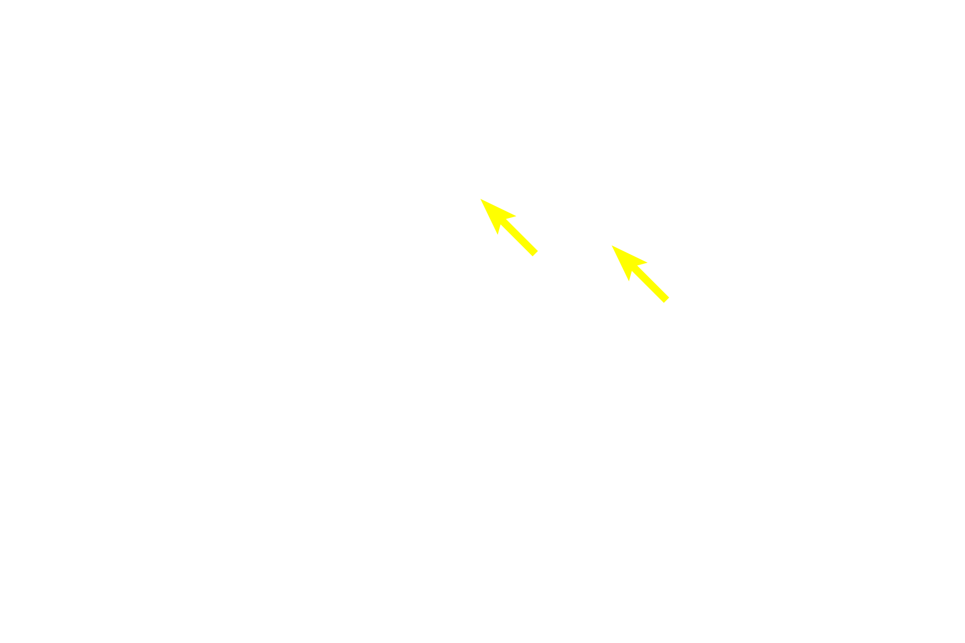 Interlobular connective tissue <p>A compound, tubuloacinar gland consists of both tubular and acinar secretory units and the gland is subdivided by connective tissue into lobules   Draining the secretory units are intralobular ducts, which are contained entirely within the lobule.  Interlobular ducts are located in the interlobular connective tissue and drain multiple lobules.  This gland is the submandibular (submaxillary) gland which is one of the major salivary glands.  Submandibular gland  40x</p>
