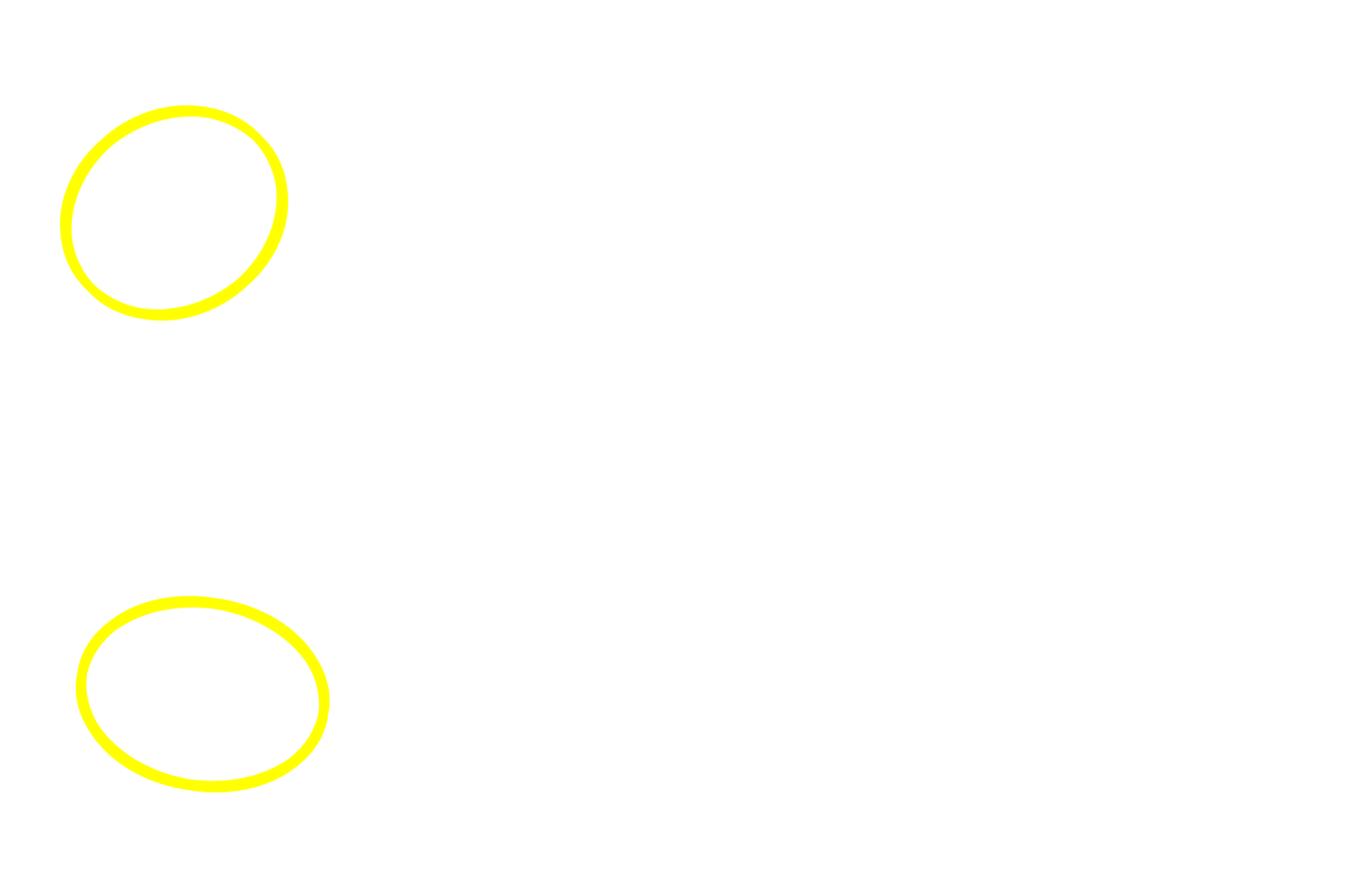 Intralobular ducts <p>The secretory units in this gland consist of spherical acini and elongated tubules.  Their secretions are immediately drained by intralobular ducts which flow into larger interlobular ducts located in the interlobular connective tissue between lobules.  Interlobular ducts are often lined by a stratified columnar epithelium.  Submandibular gland 400x</p>
