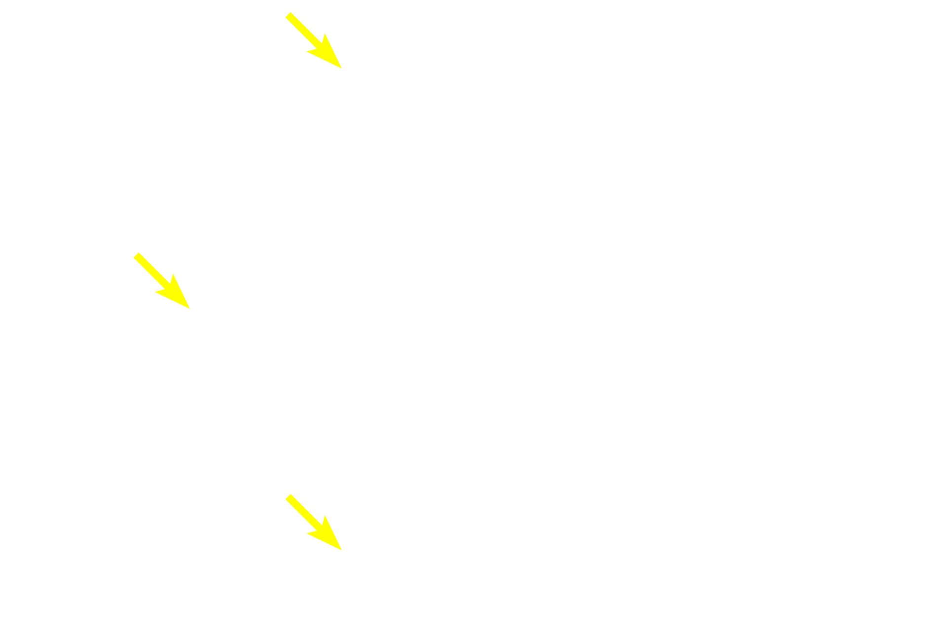 Tubules <p>The secretory units in this gland consist of spherical acini and elongated tubules.  Their secretions are immediately drained by intralobular ducts which flow into larger interlobular ducts located in the interlobular connective tissue between lobules.  Interlobular ducts are often lined by a stratified columnar epithelium.  Submandibular gland 400x</p>
