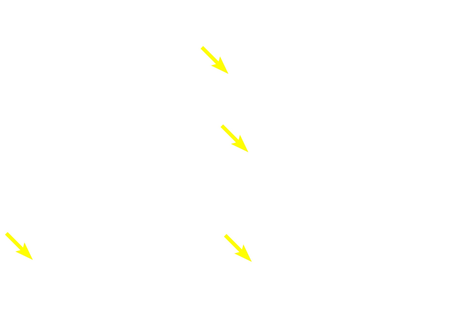 Acini <p>The secretory units in this gland consist of spherical acini and elongated tubules.  Their secretions are immediately drained by intralobular ducts which flow into larger interlobular ducts located in the interlobular connective tissue between lobules.  Interlobular ducts are often lined by a stratified columnar epithelium.  Submandibular gland 400x</p>
