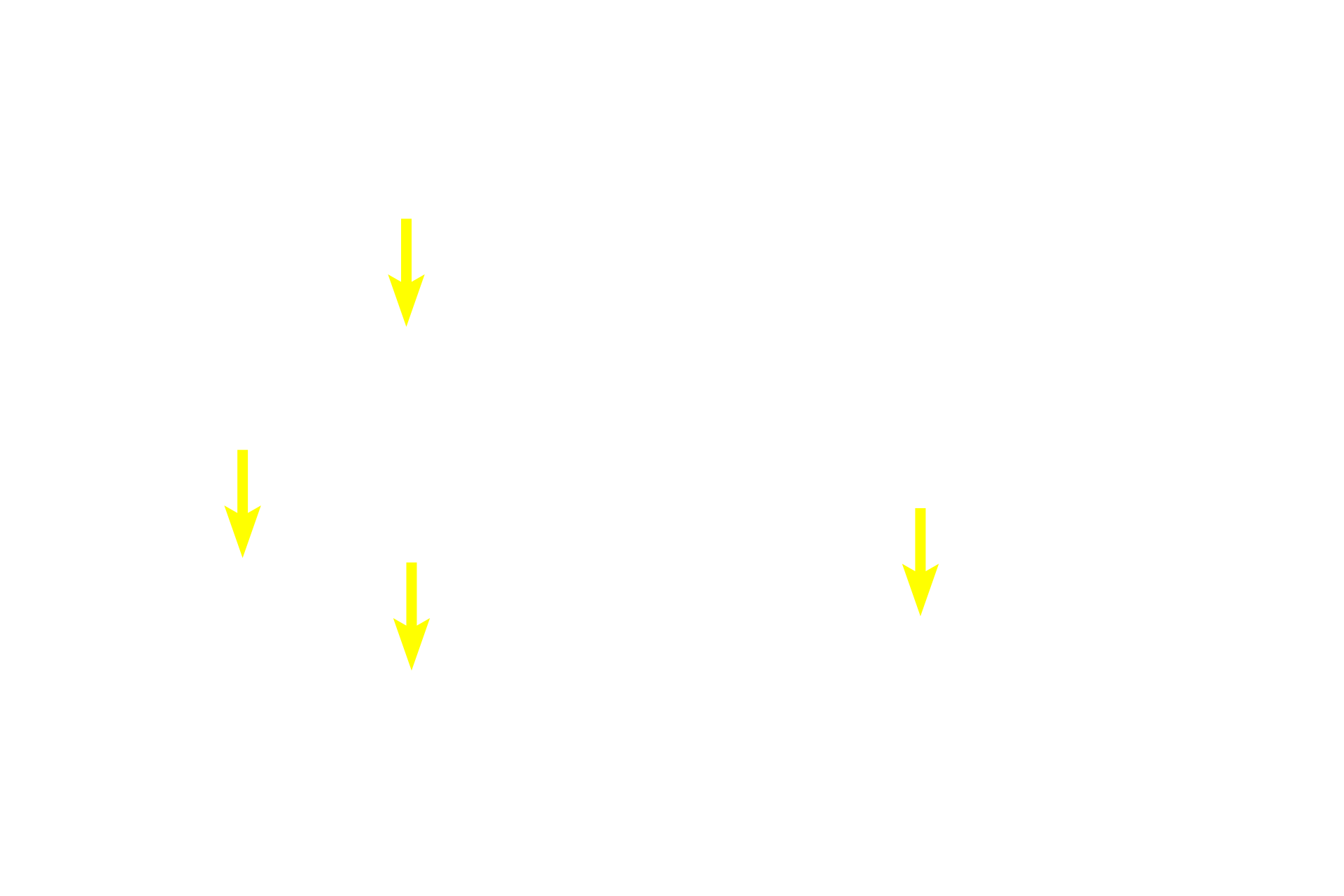 Serous-secreting acini <p>A lobule of a compound tubuloacinar gland displays both elongated, mucus-secreting tubules and spherical, serous-secreting acini.  Intralobular ducts are also visible.  This gland is the submandibular (submaxillary) salivary gland and the saliva it secretes contains both mucus and serous components.  400x</p>
